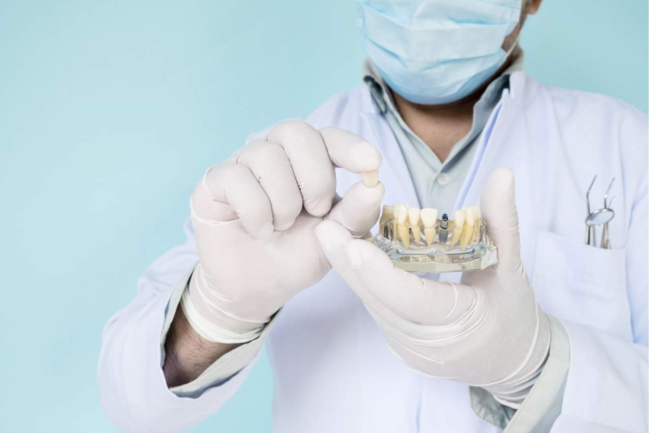 Implante Dentix en Sevilla