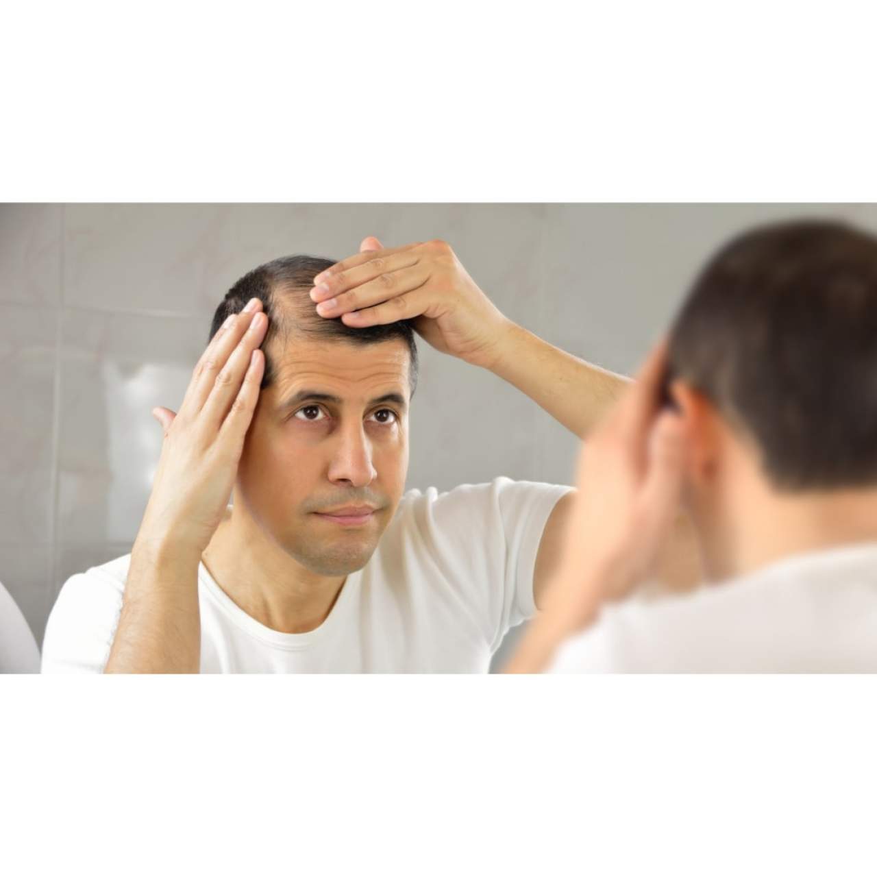 Dr. Carlos Zito, mejor clínica para prevenir la caída del cabello en Barcelona