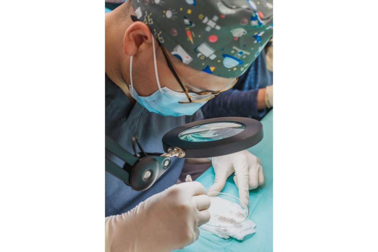Adcure Clinic se convierte en el centro número uno en la técnica de implantación DHI