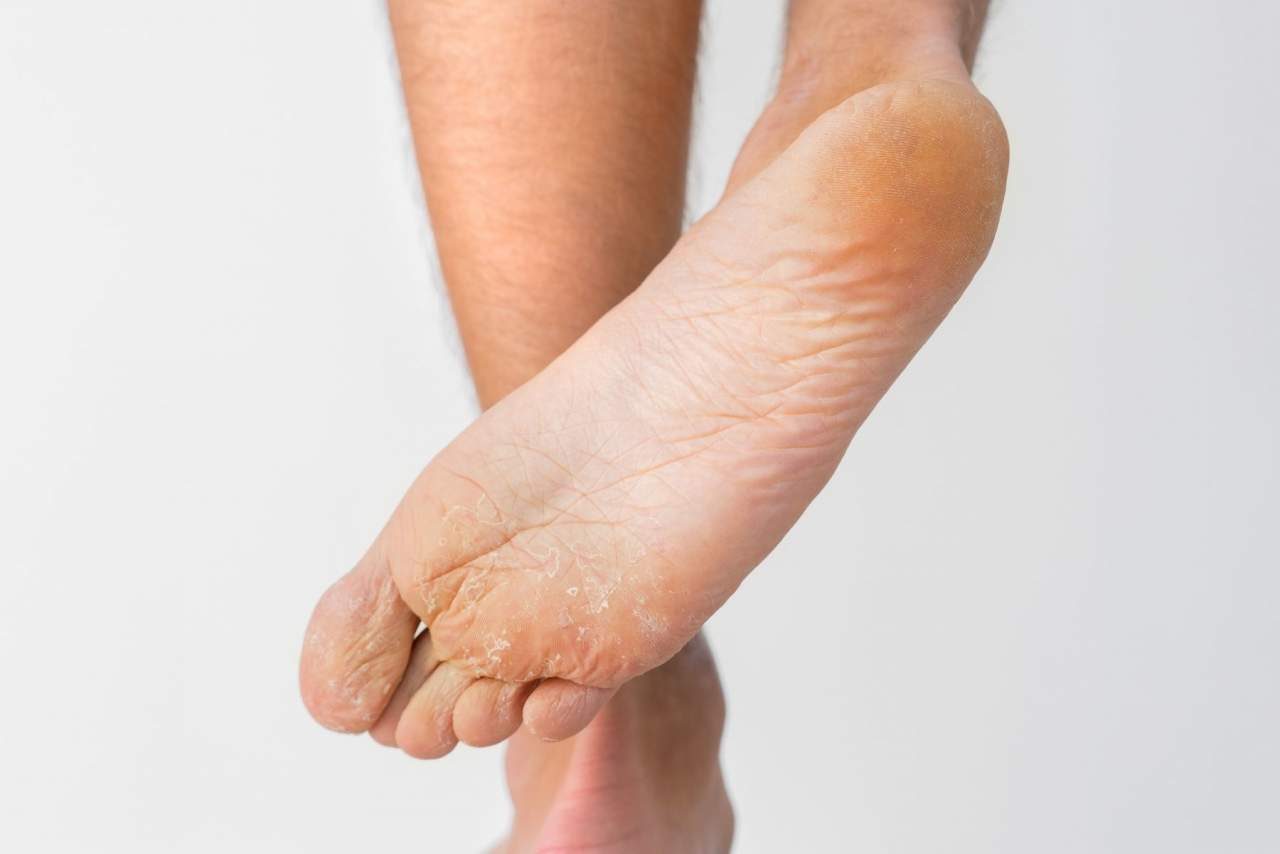 Tejido técnico para curar heridas, la revolución de Parafarmacia Integrativa