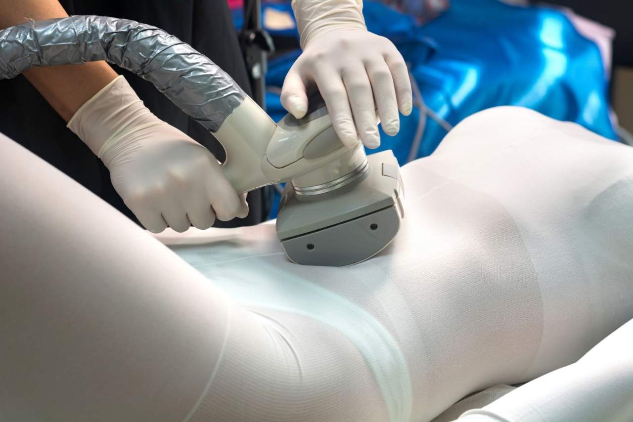 ¿Es eficaz el LPG en Arrasate para operación bikini?