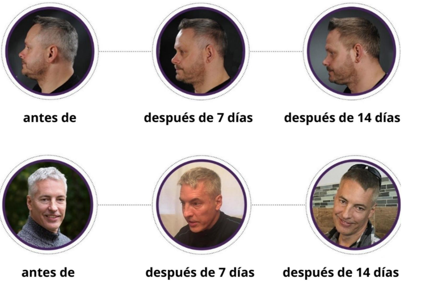 Loción GR-7 Professional se establece como respuesta al Cómo tapar las canas sin tinte