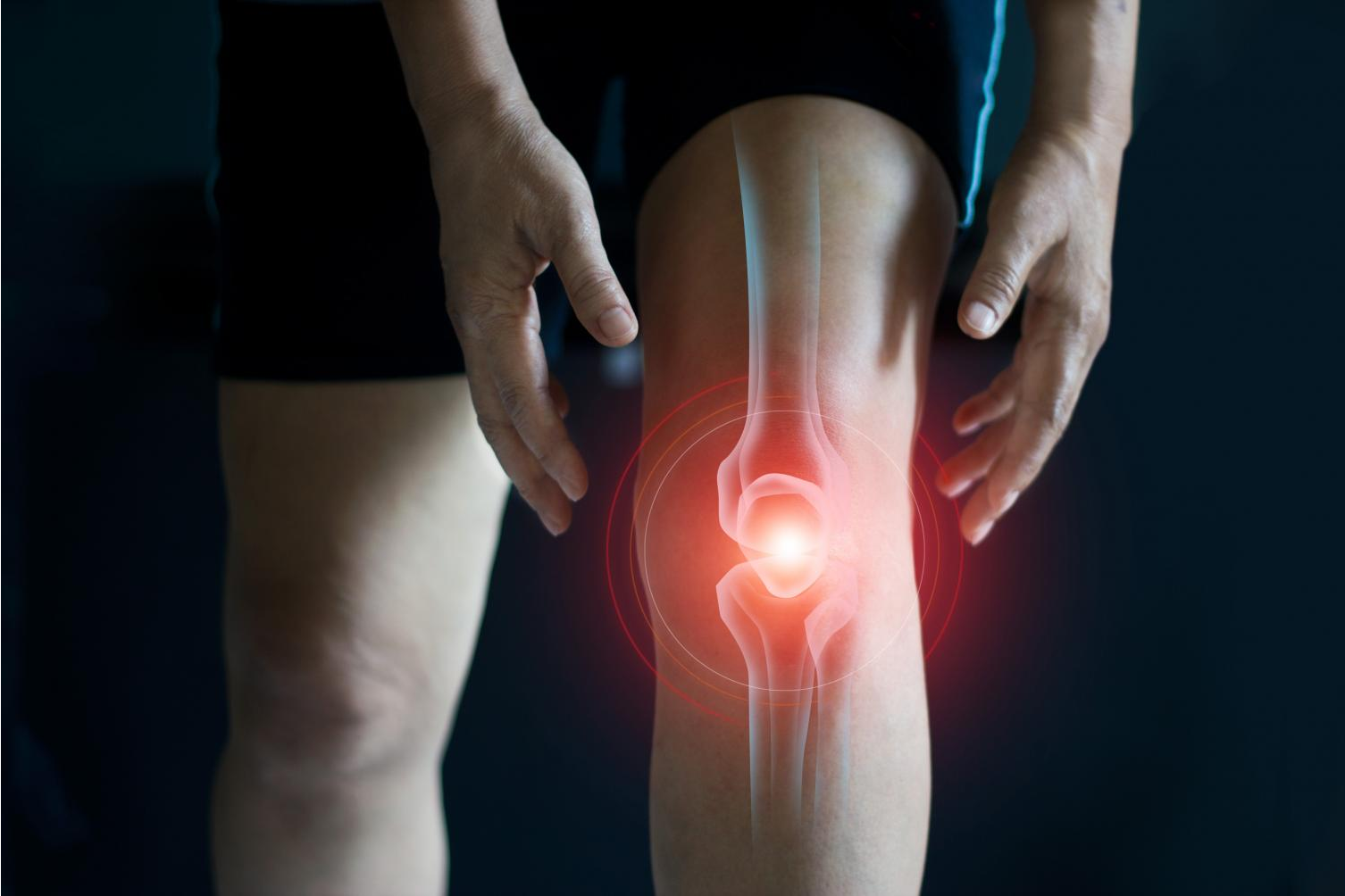 Colágeno con silicio de Novonatur: suplemento vitamínico para proteger los huesos y los ligamentos
