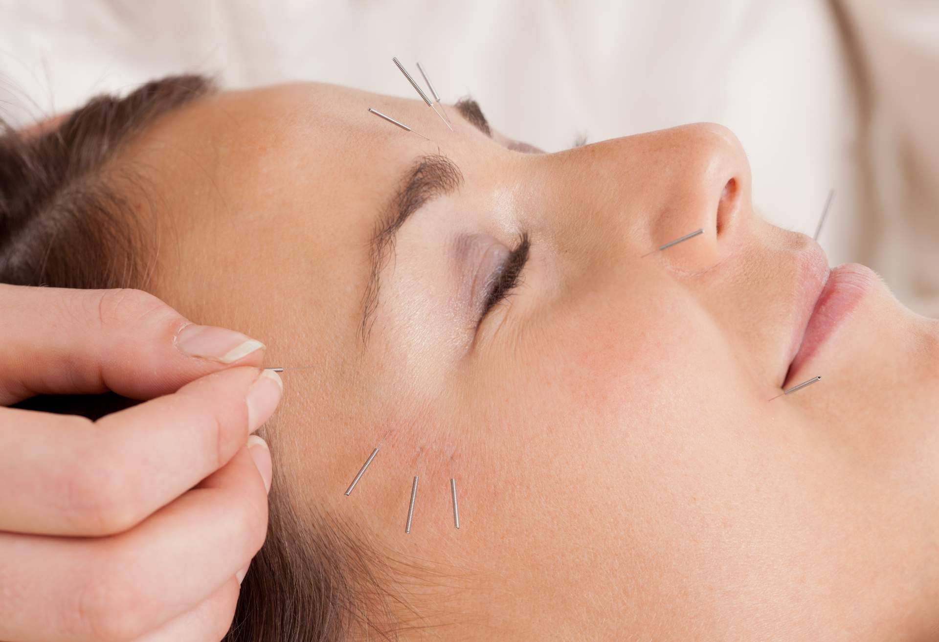 Kikai: acupuntura estética a domicilio por el centro