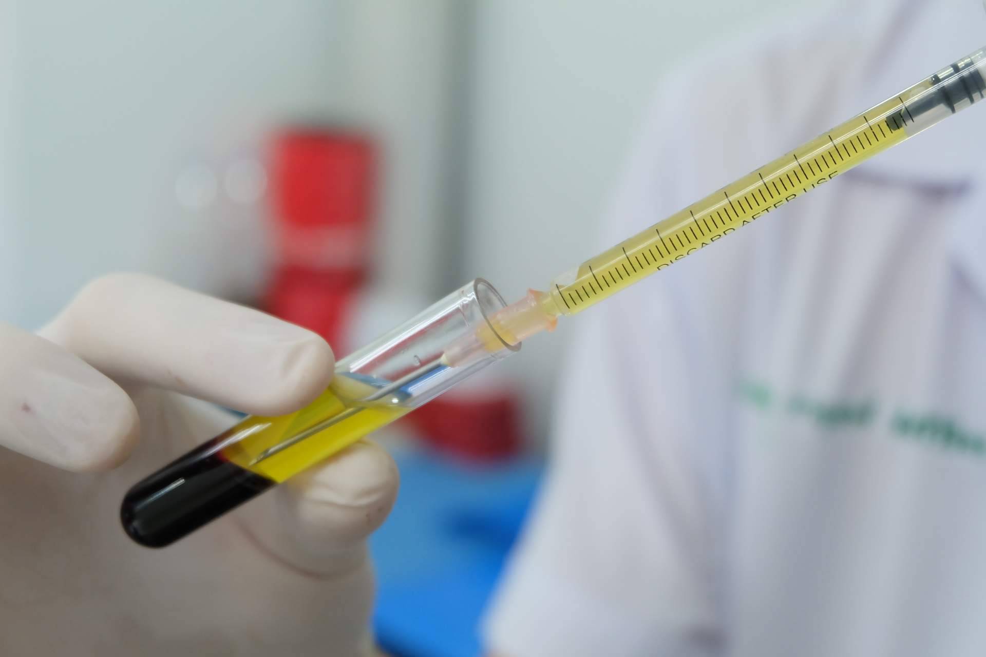 Tratamiento de plasma rico en plaquetas en Clínica Estética Alicante Rosa Mora
