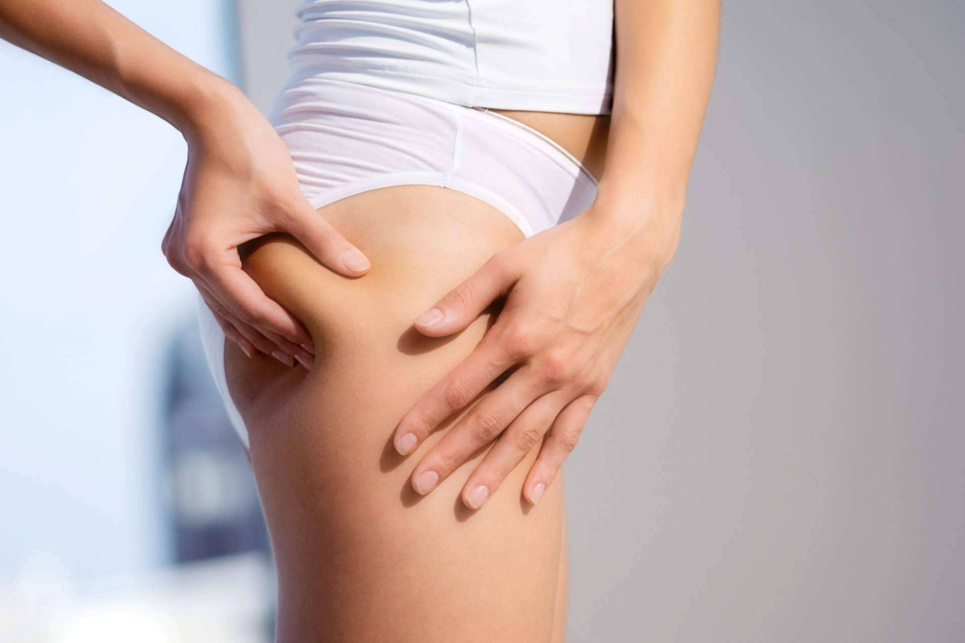¿Cómo combatir la celulitis de una forma natural?, por Sincelut Forte