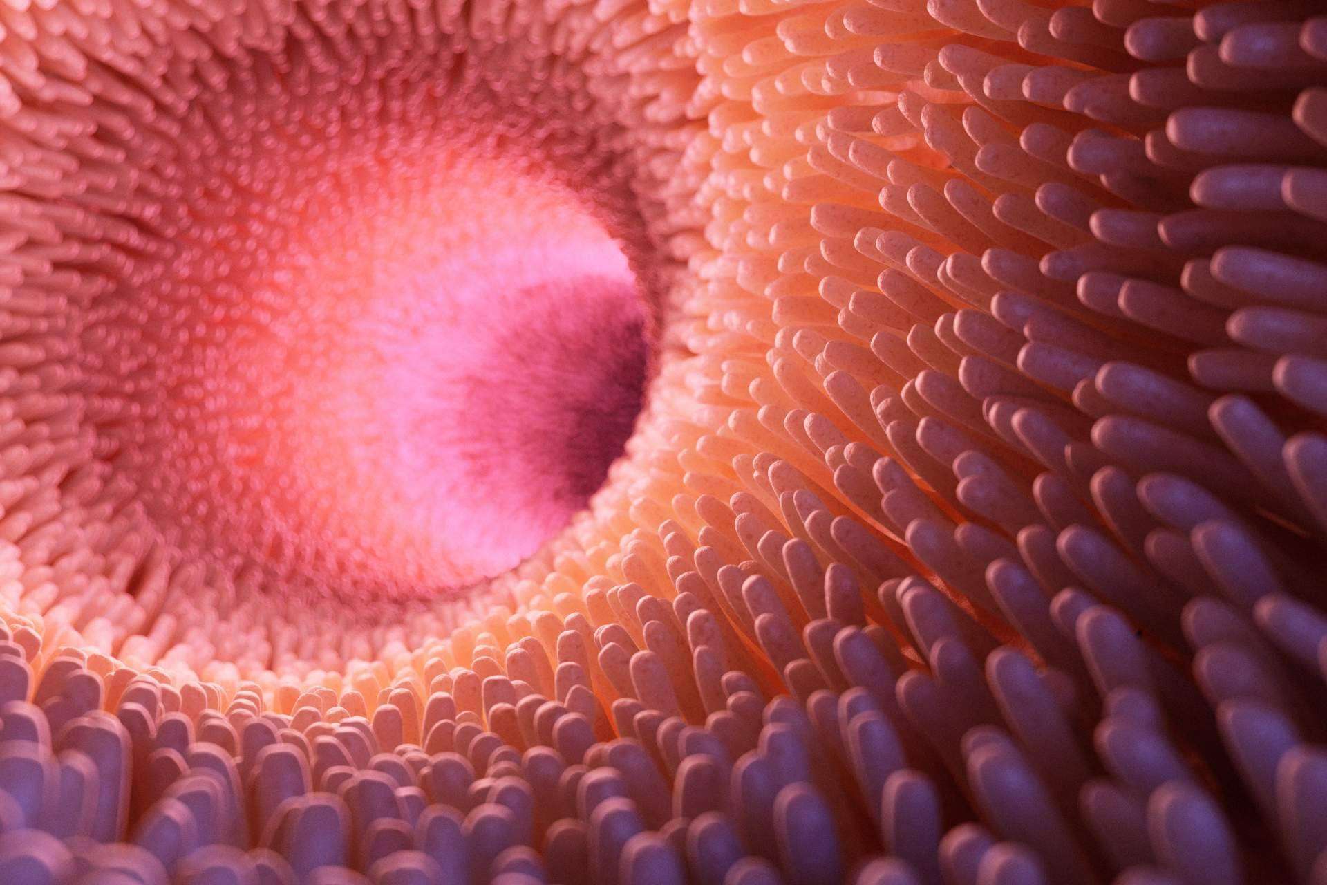 ¿Existe cura para la disbiosis intestinal?