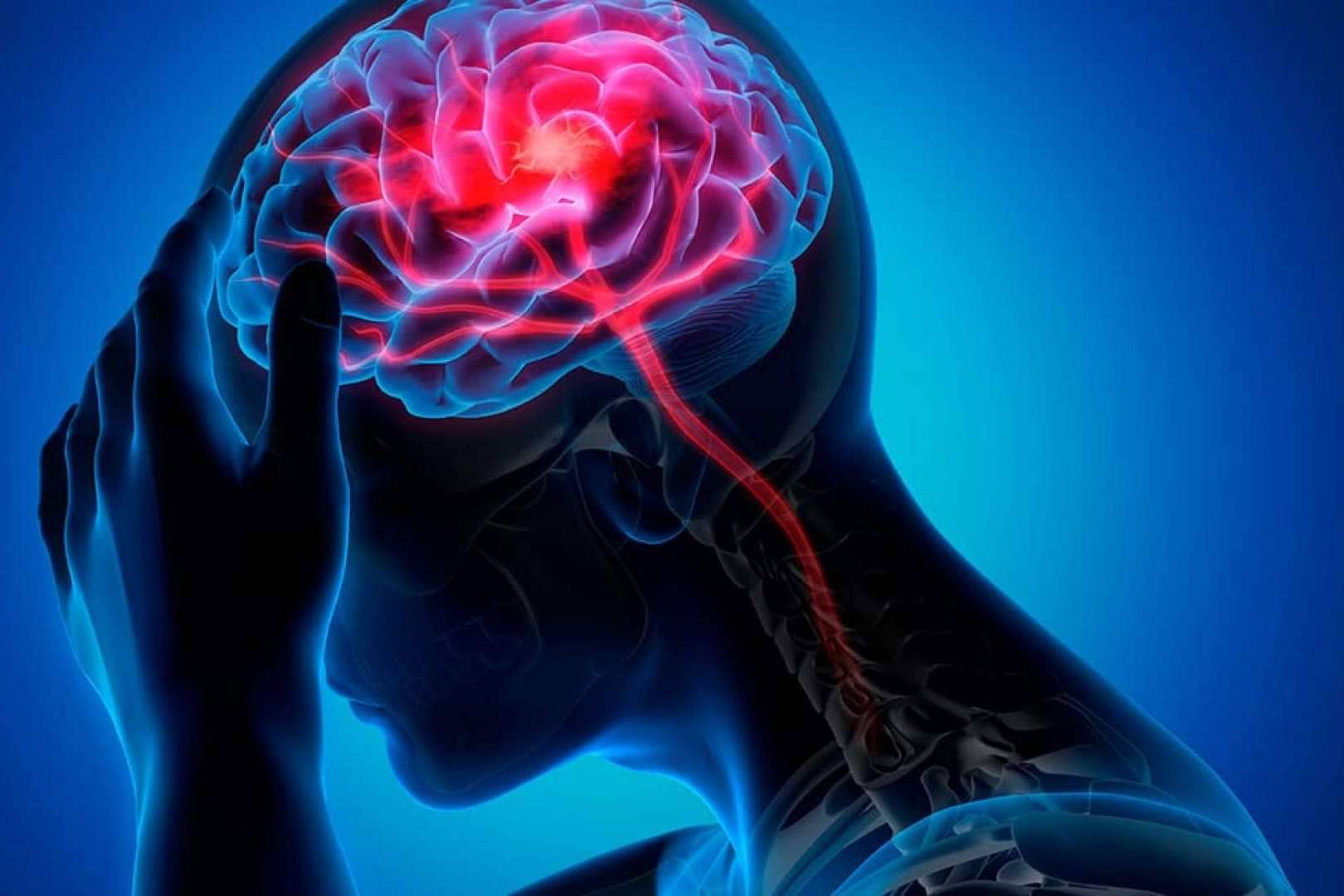 El tratamiento de la migraña con osteopatía de la mano del Instituto Internacional de Osteopatía Avanzada
