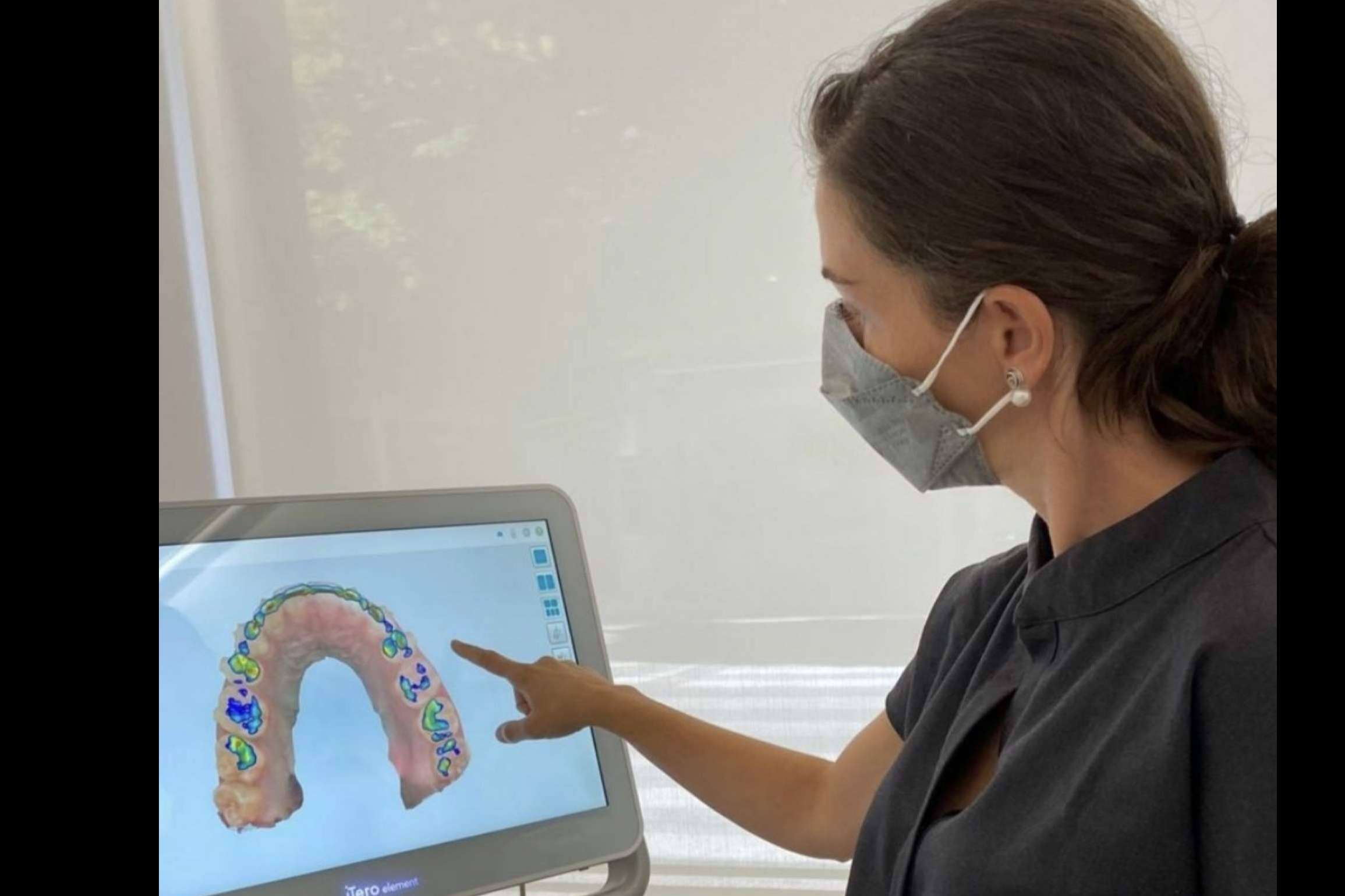 Ventajas ofrecidas por el tratamiento Invisalign, por Clínica dental Carmen Díaz