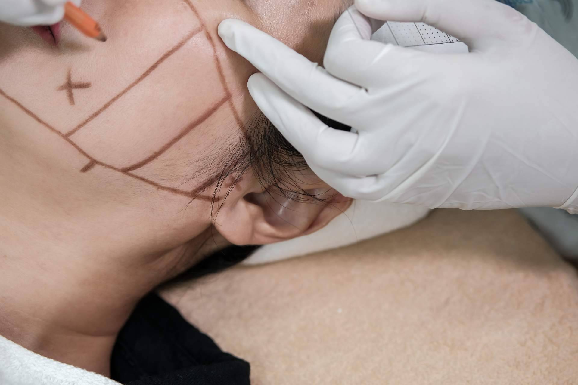 CB Clinic apuesta por HIFU Facial con Ultrasonidos