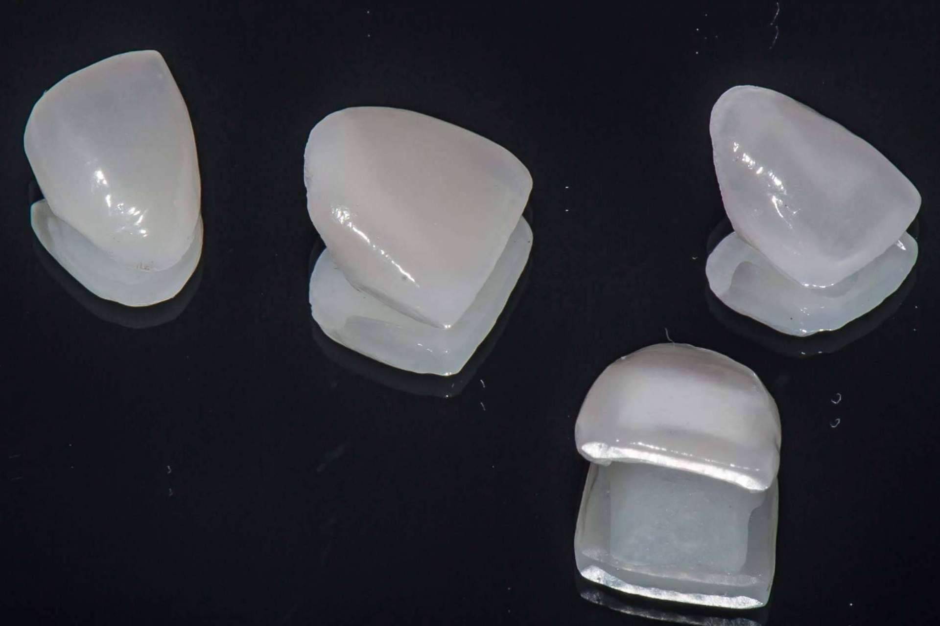 Carillas dentales de porcelana para mejorar la estética dental