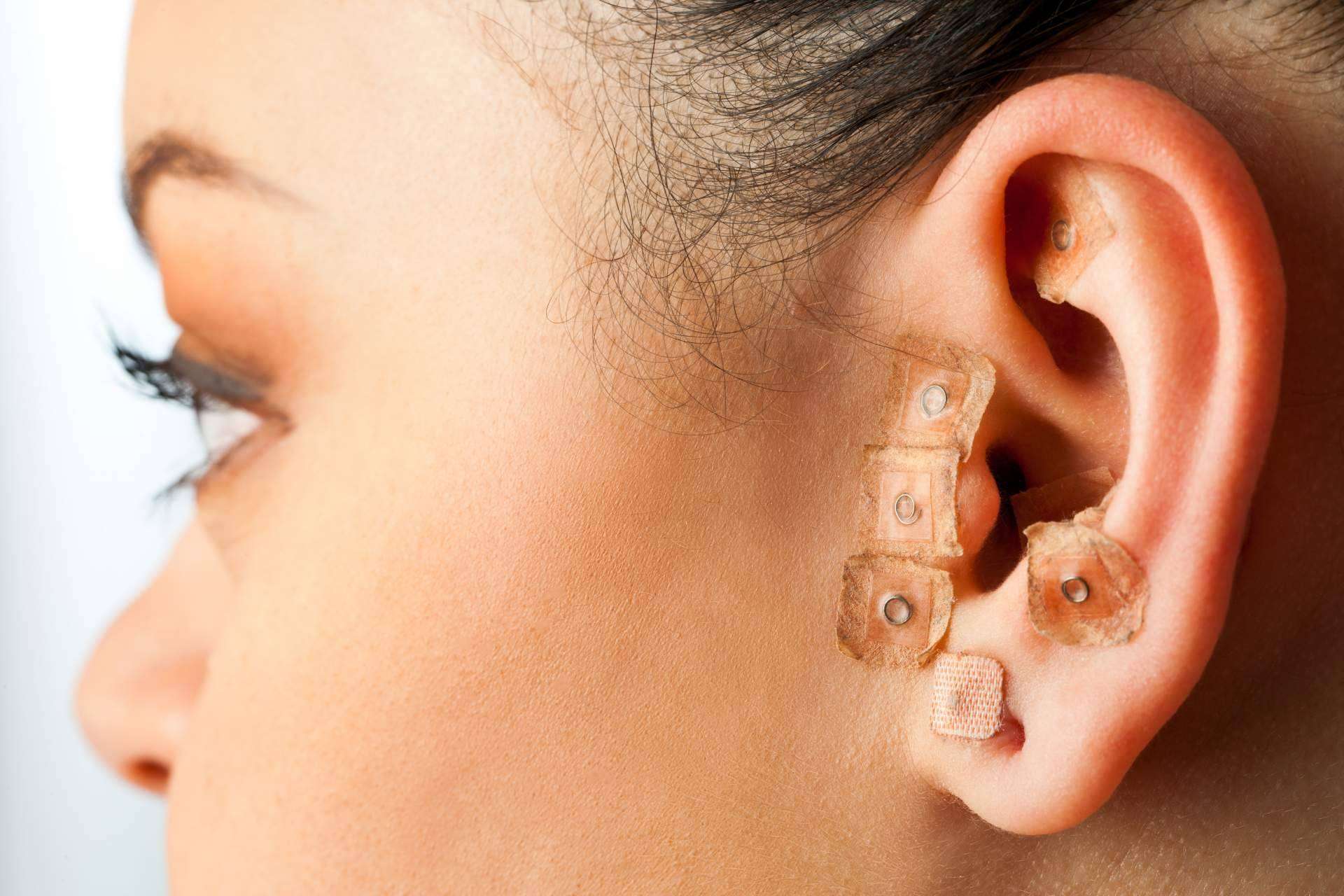 Auriculoterapia, técnica natural de Rambla 6 coadyuvante en el tratamiento del dolor, ansiedad y adicciones