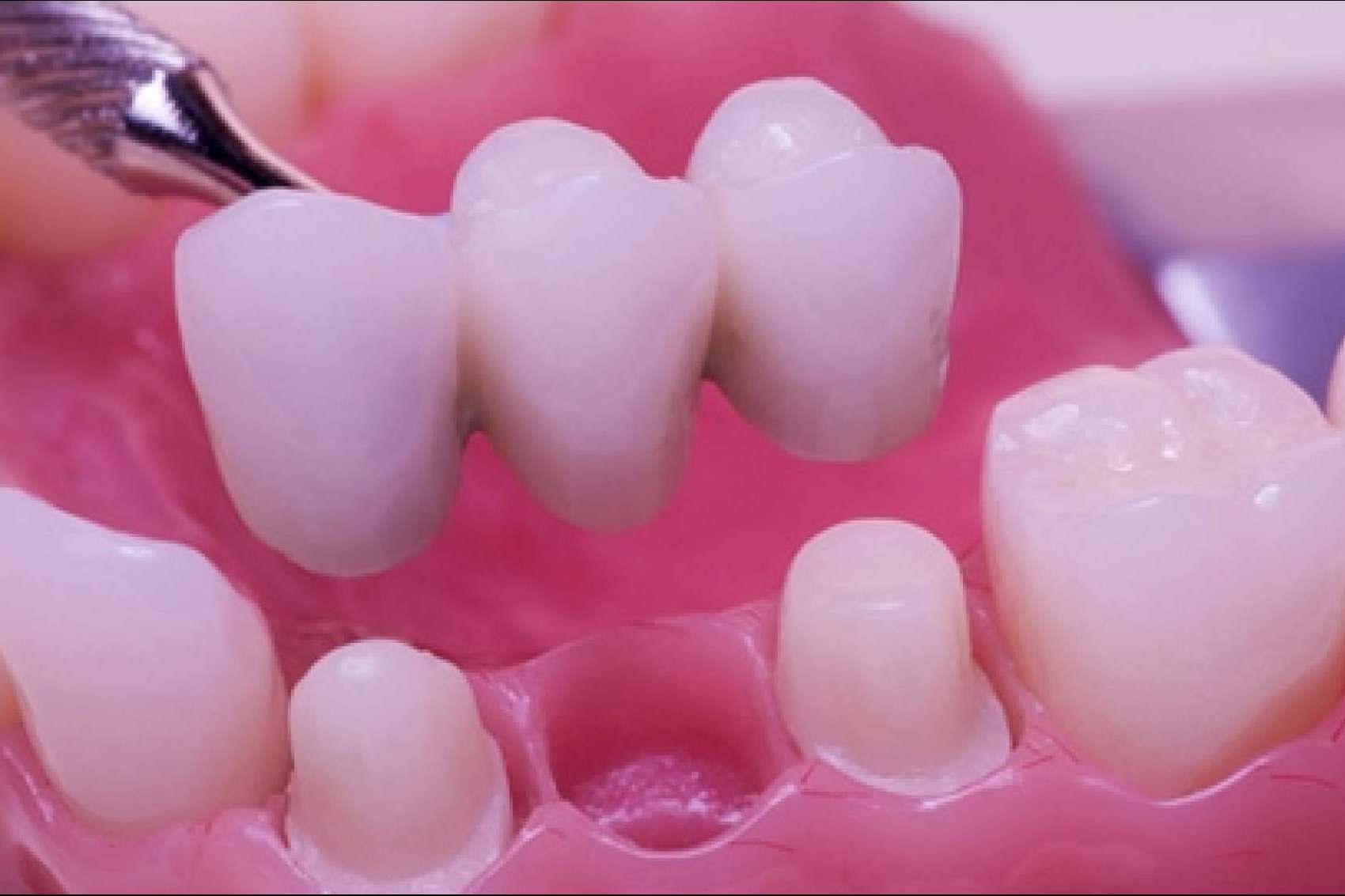 La clínica Dental Implantologie ofrece laboratorio propio para el servicio de estética dental y ortodoncia invisible