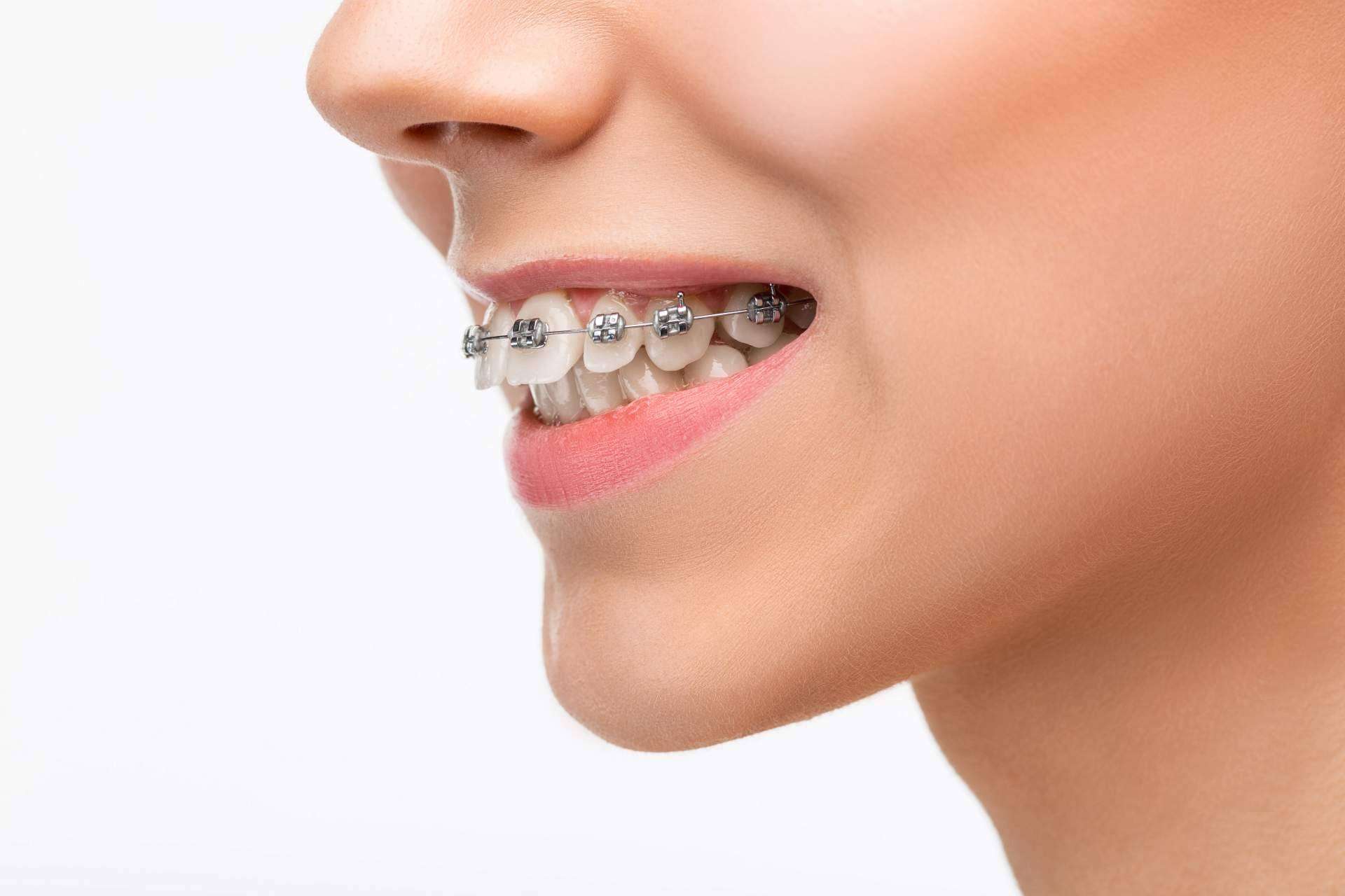 Corregir a tiempo la dentadura con la ortodoncia infantil garantiza una óptima salud bucal, según Corporación Dental situada en Córdoba