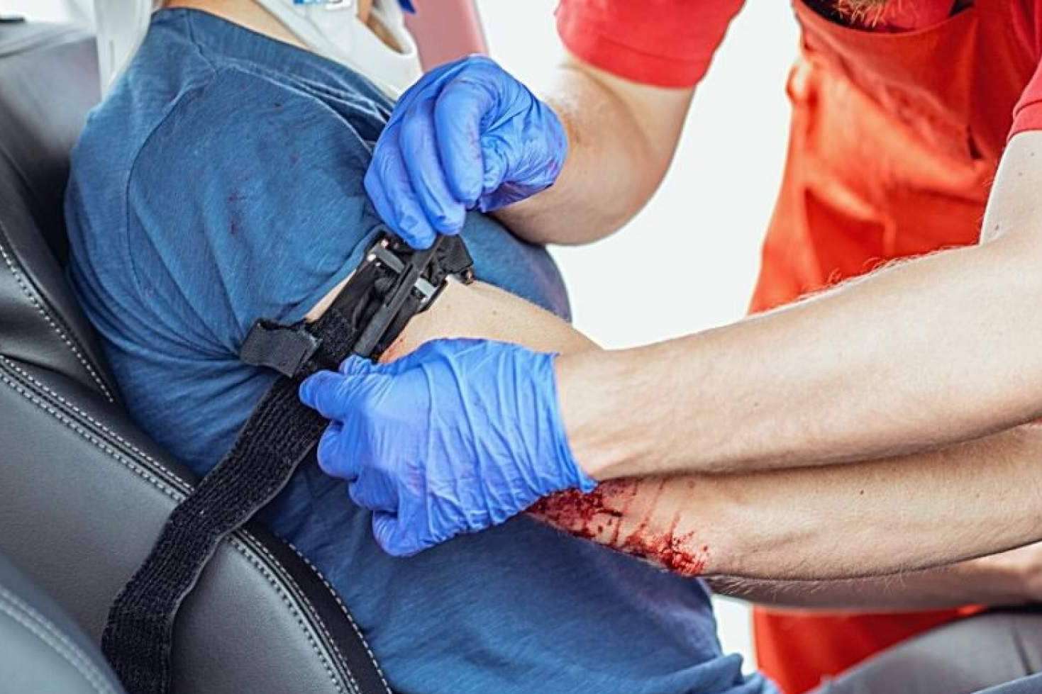 ¿Cuándo y cómo hacer un torniquete?
