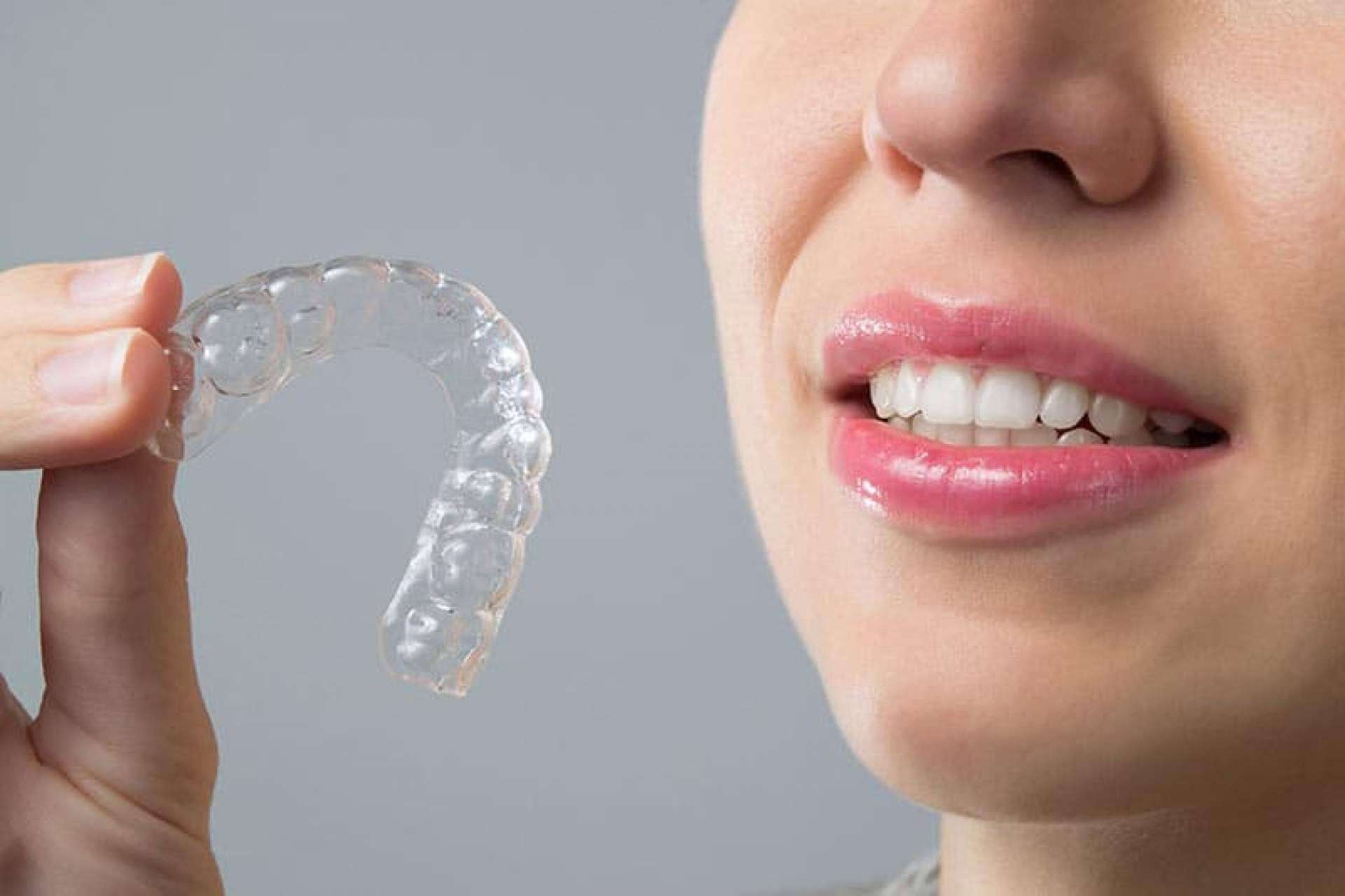 Alineación de dientes con la ortodoncia invisible Invisalign®, en la Clínica Dental Ahoa