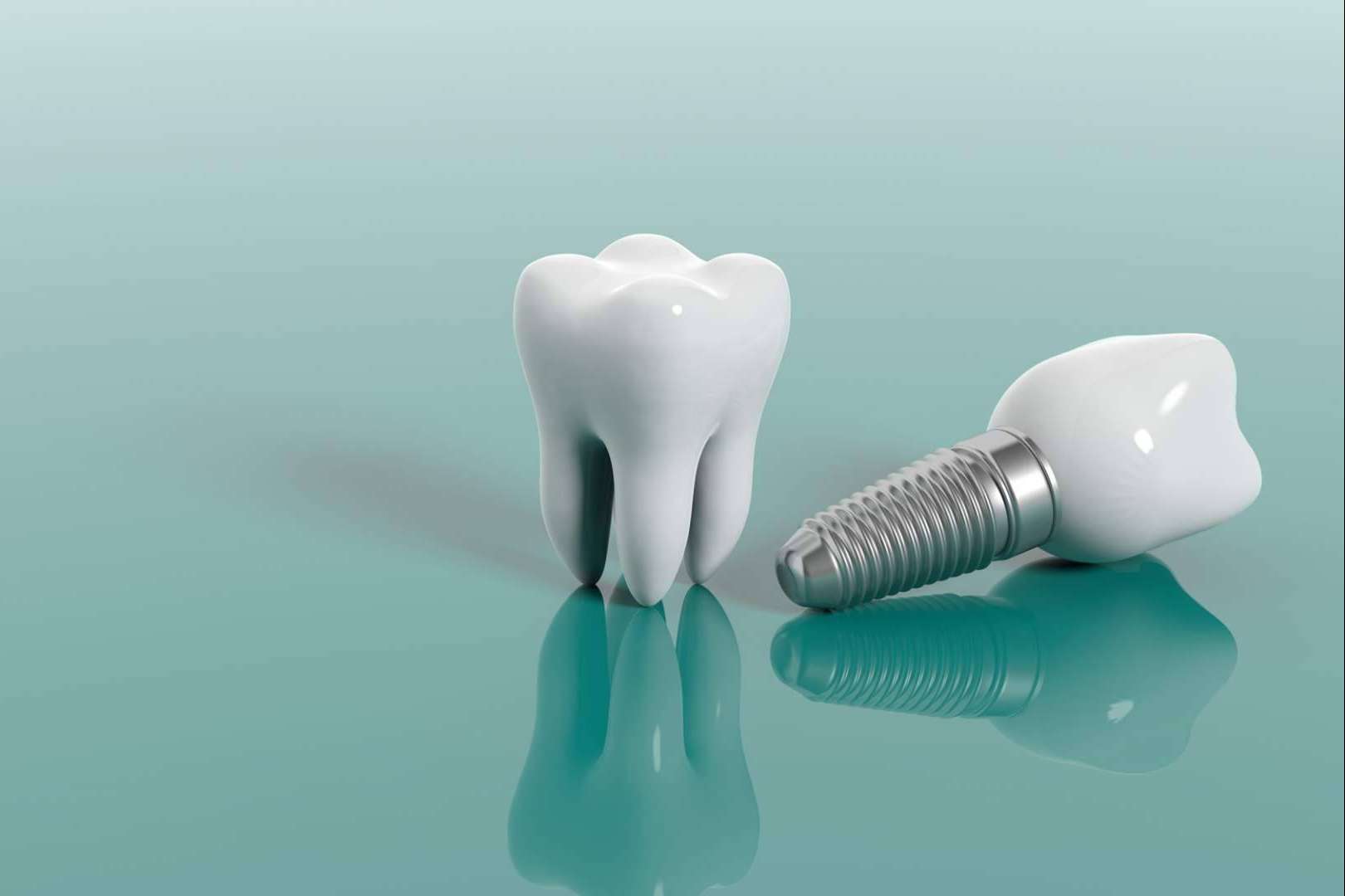 La implantología dental de carga inmediata de Clínica Dental Ahoa
