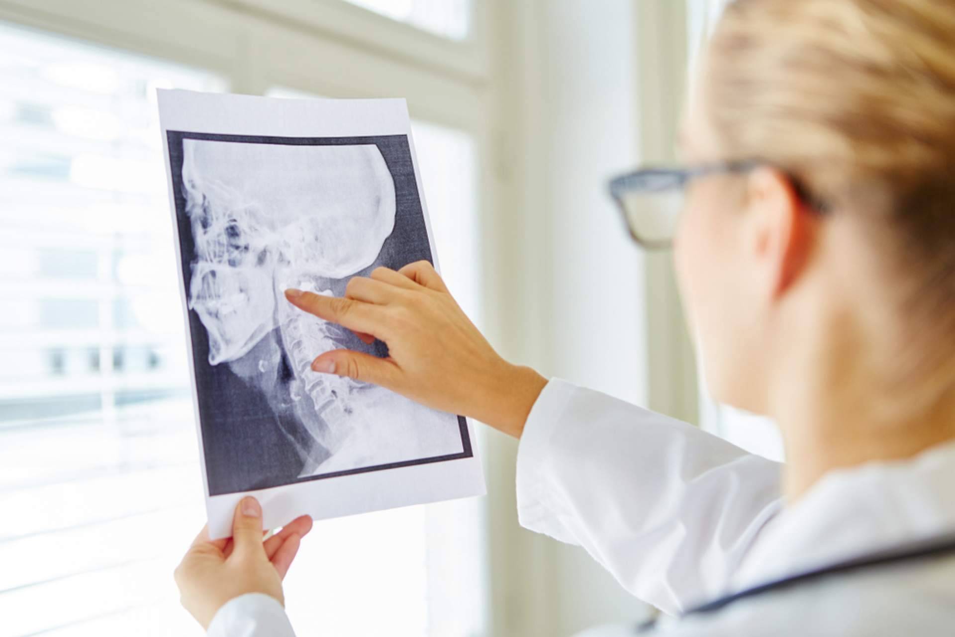 Los servicios de Clínica Birbe relacionados con la cirugía maxilofacial
