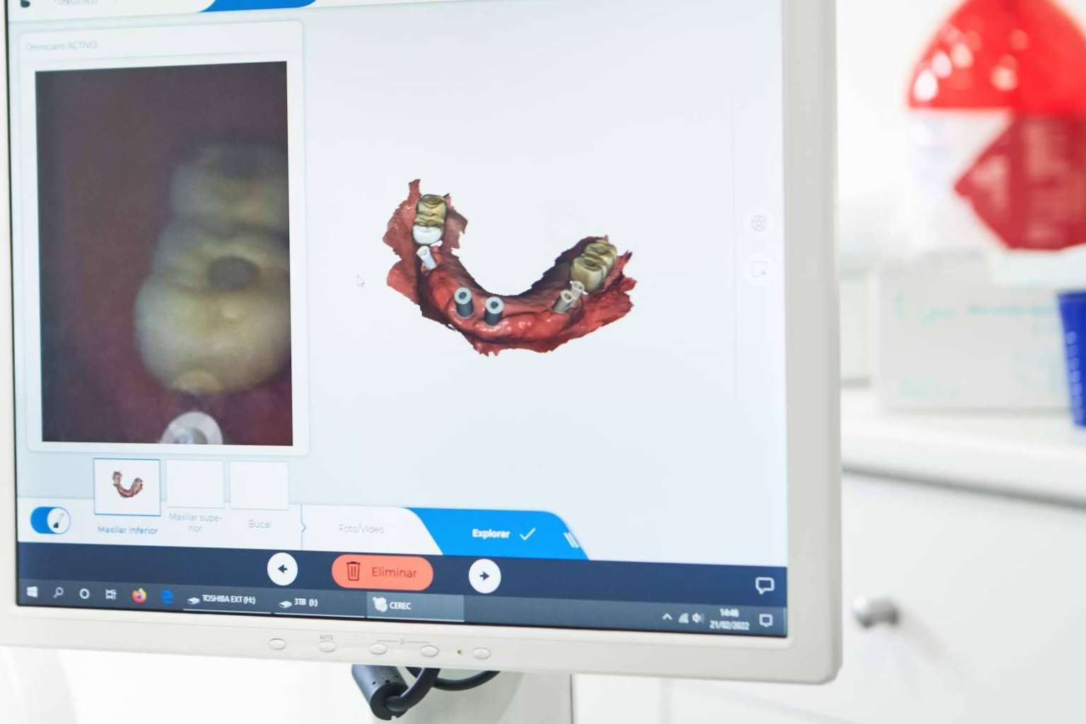 Rehabilitación oral en un solo día, de la mano de BORDONCLINIC