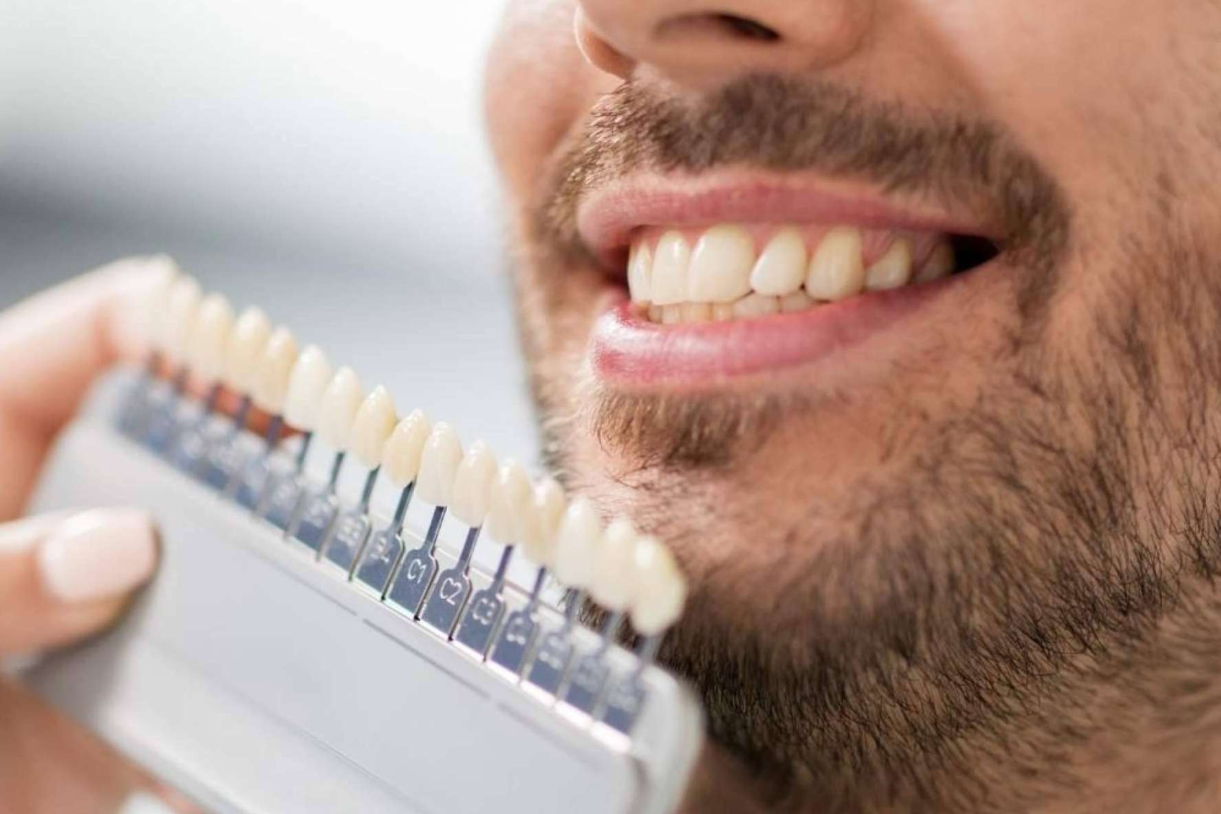 Las carillas dentales ayudan a recuperar la estética de la sonrisa en un día
