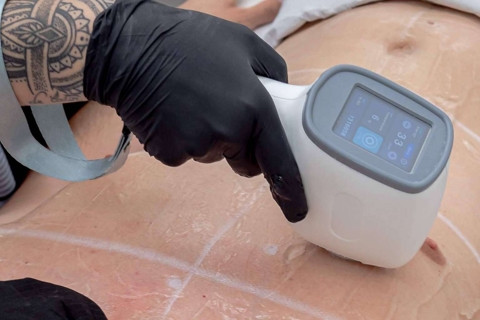 La eficacia en la depilación laser, por Sapphira Privé