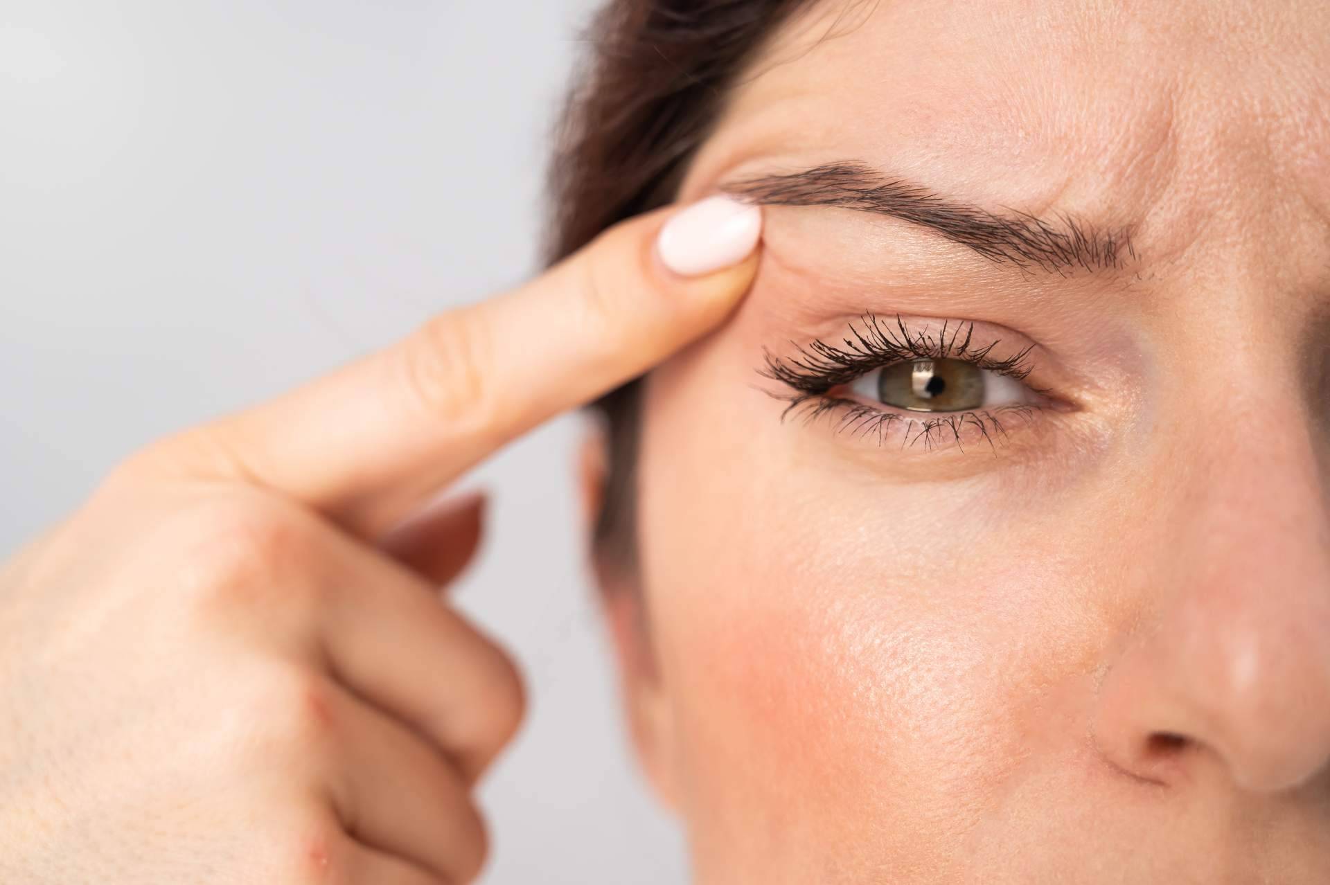 La Clinica de Medicina Estética Elegansse, referente de blefaroplastia mínimamente invasiva de Barcelona