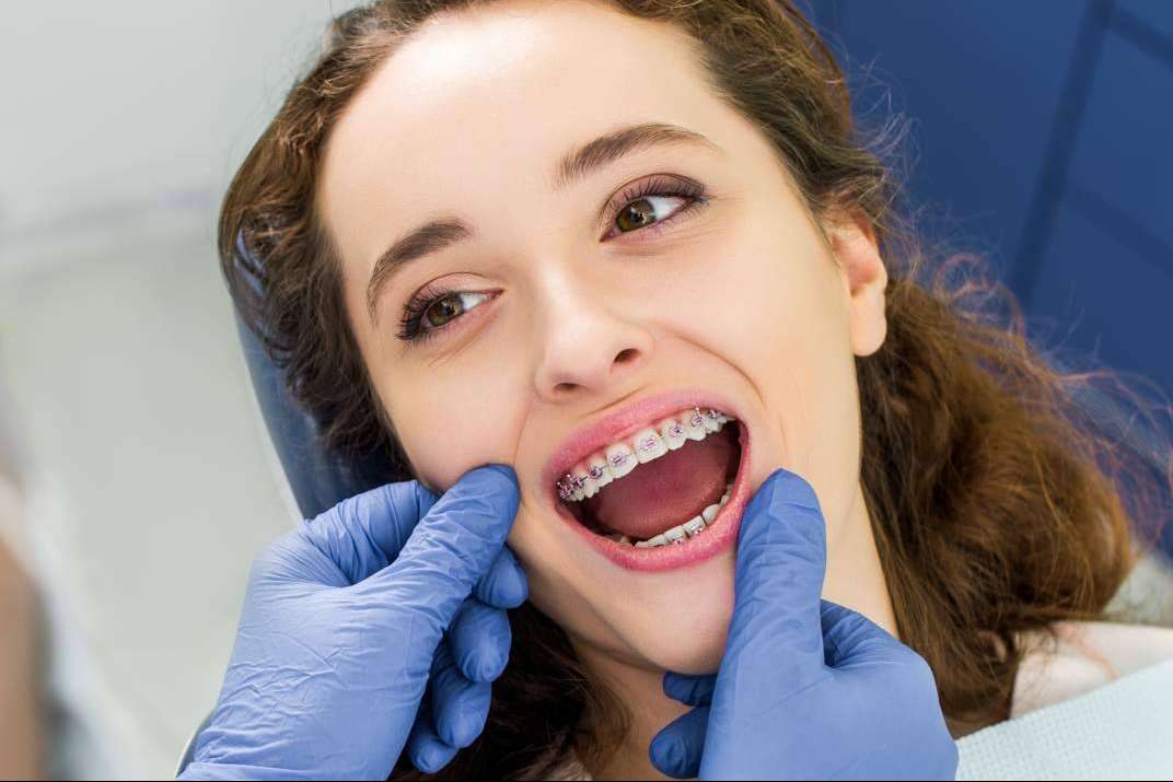 Agudo Rosa señala las ventajas de la ortodoncia estética