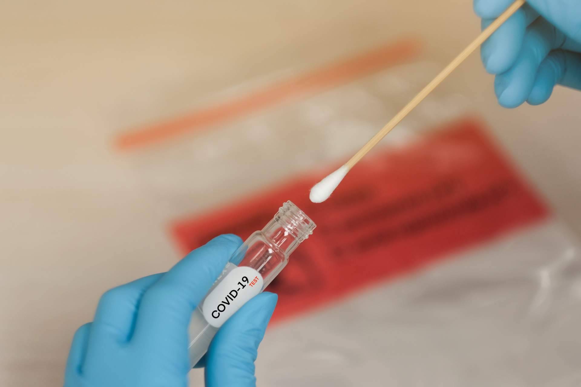 Realizar un test covid Madrid para estar tranquilo en las comidas y cenas con familiares, gracias a Centro Médico Bravo