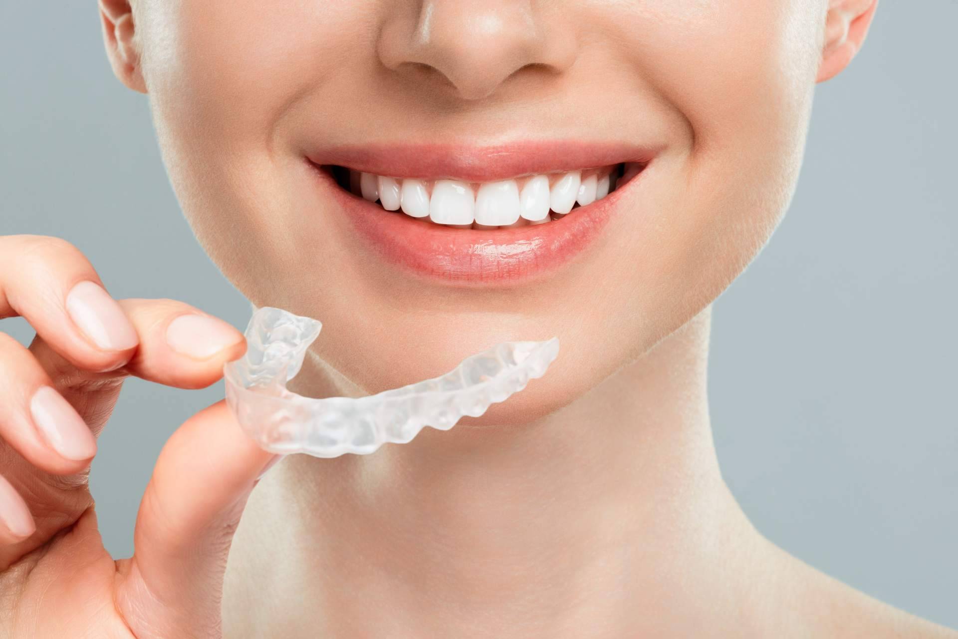 Conseguir una sonrisa perfecta de la mano de los profesionales de la clínica Carlos Saiz Smile