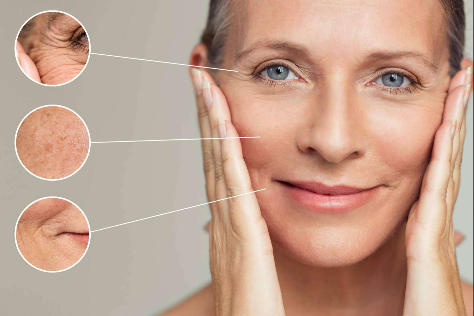 Borrar arrugas y cicatrices con el 'lápiz' Dermapen de 360Clinics