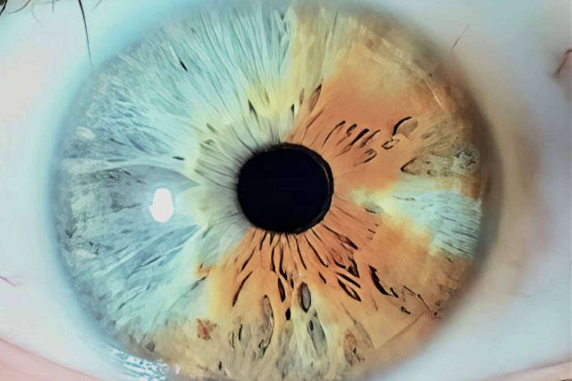 Eyecos presenta el gran libro Atlas sobre el cambio de color de ojos con láser