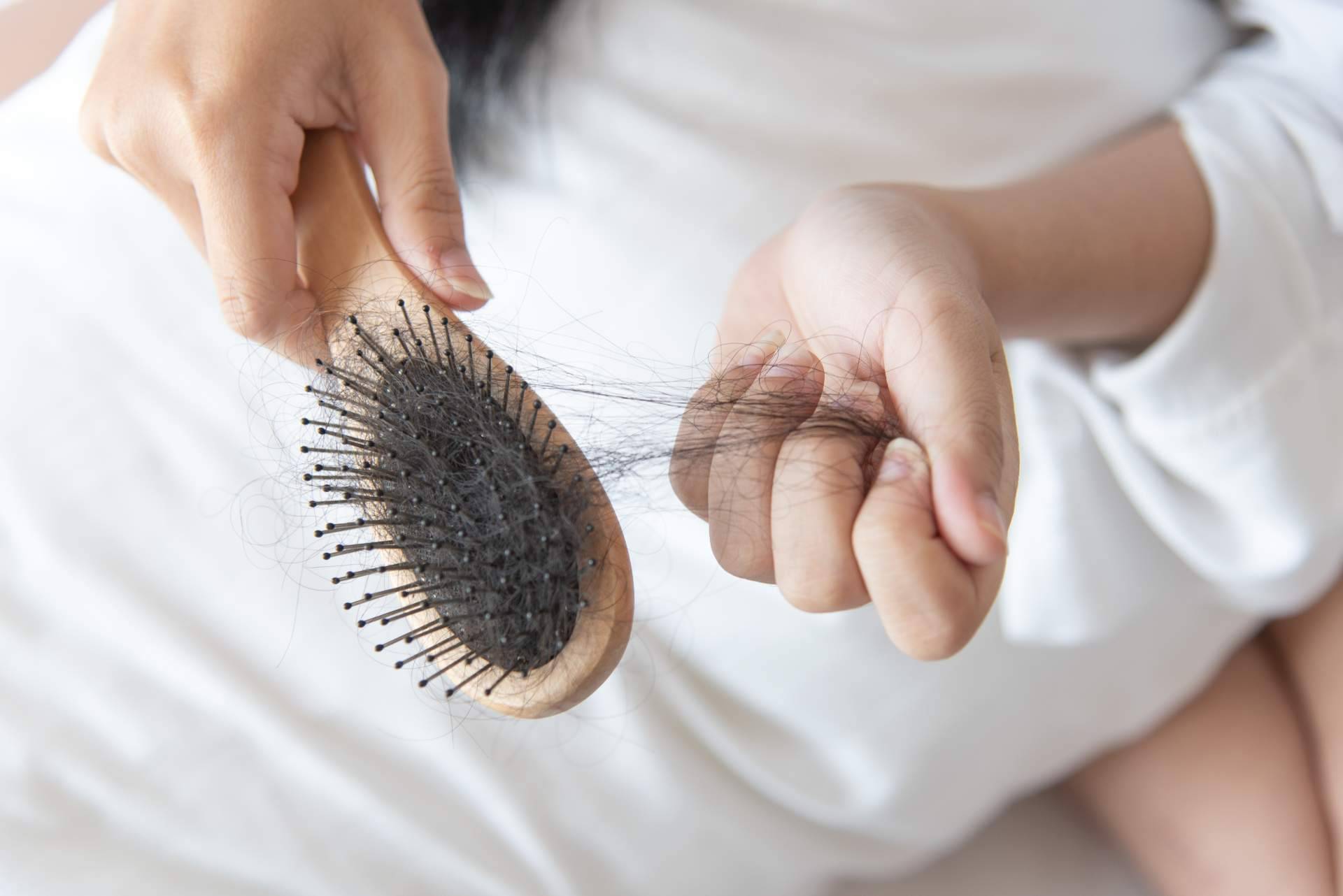 Razones por las que se cae más el cabello en primavera y cómo tratarlo