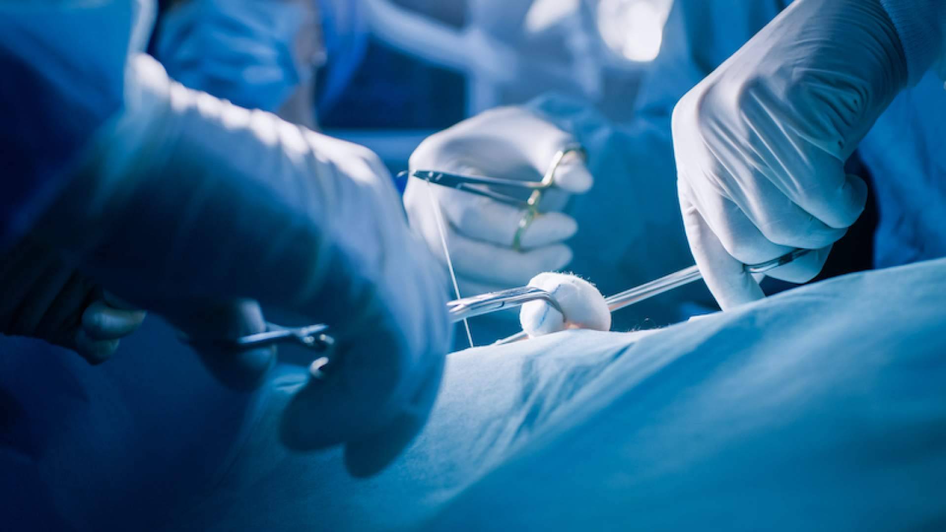 Innova Cirugía, referentes en la utilización de tecnología avanzada para tratar el sinus pilonidal