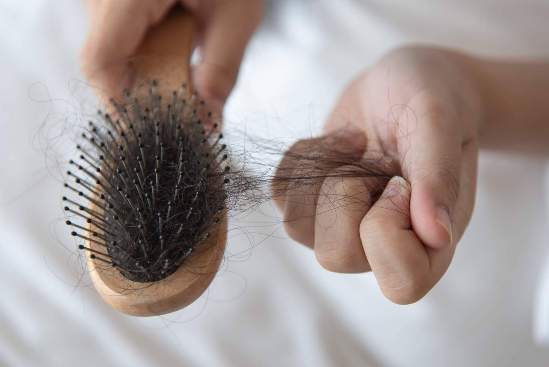 ¿Cómo combatir la alopecia femenina? El método de Capilar Innovation Clinic