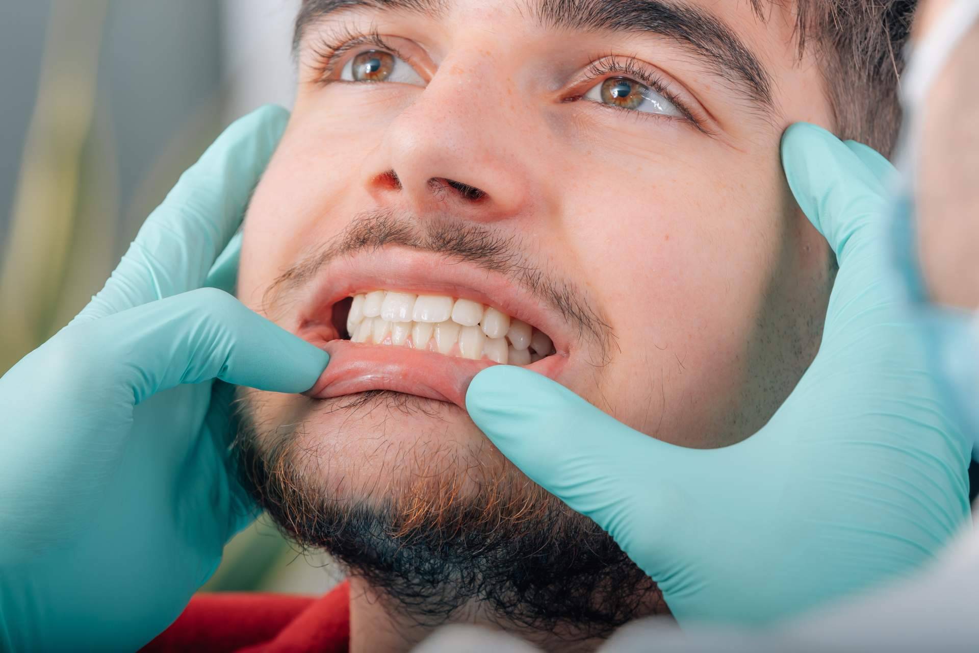 Clínica Dental Agudo Rosa explica cómo tratar la enfermedad de las encías
