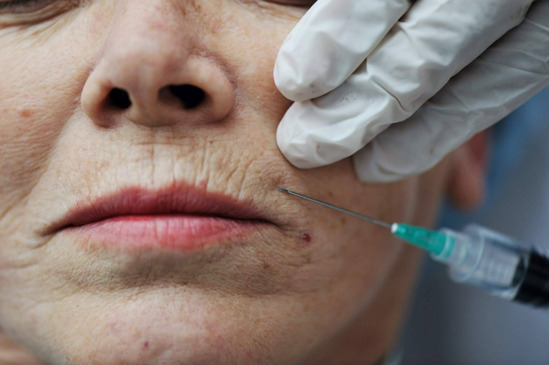 ¿En qué consiste la cirugía maxilofacial?, con Maisonnave Urban Human Clinic