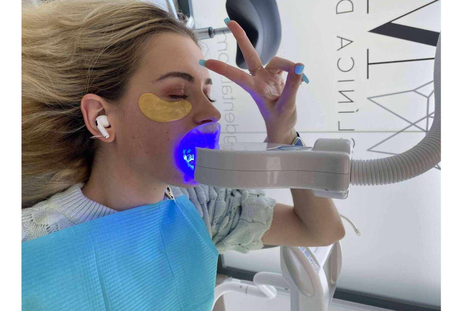 Sonrisa radiante en una sesión; blanqueamiento dental LED en Clínica MG Dental