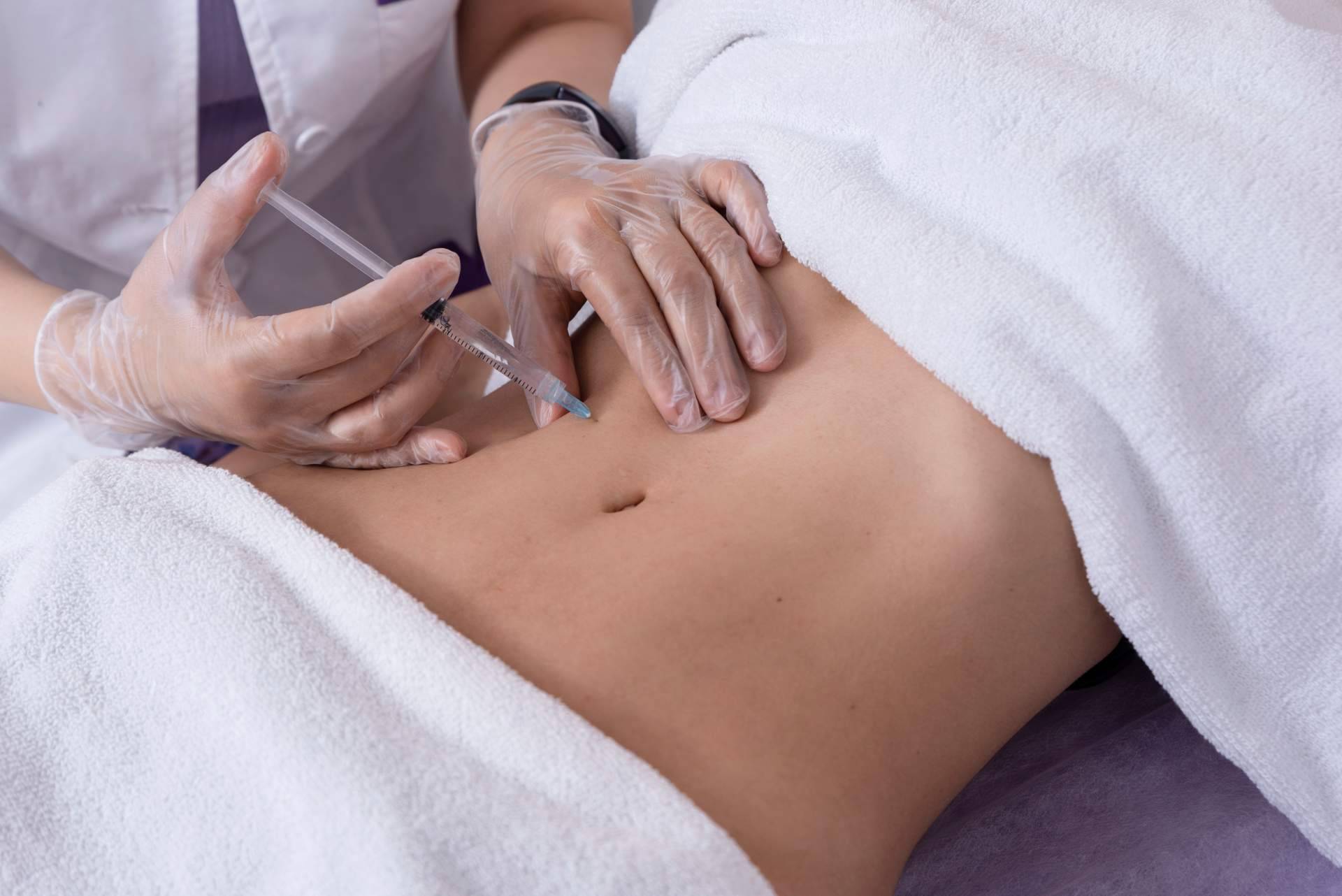 Mesoterapia efectiva contra la celulitis con Alluring Clinic