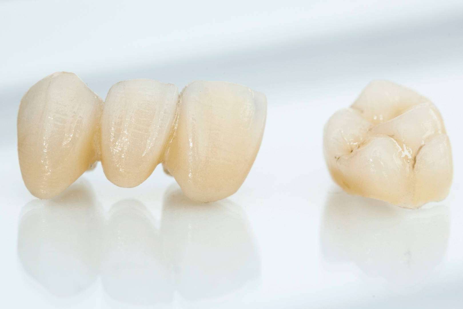Coronas dentales, la solución estética y duradera para recuperar la sonrisa perfecta por la Clínica Dental Ruiz de Gopegui