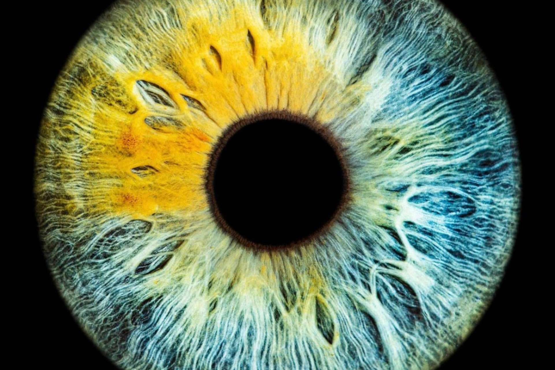 Perfil psicológico sano de los pacientes que realizan láser de cambio de color de ojos