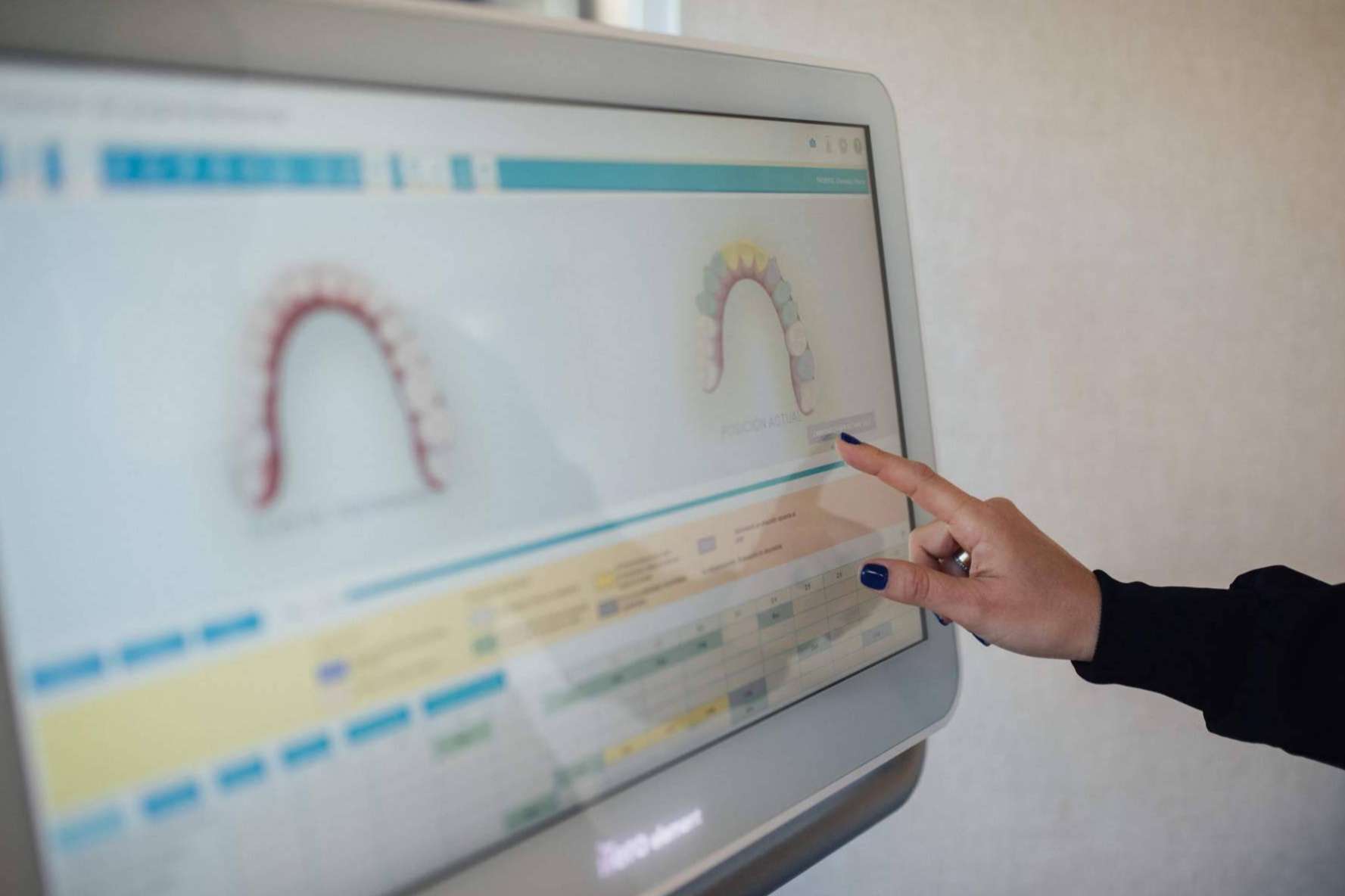 Clínica Dental Claris, especialistas en el tratamiento de patologías dentales crónicas