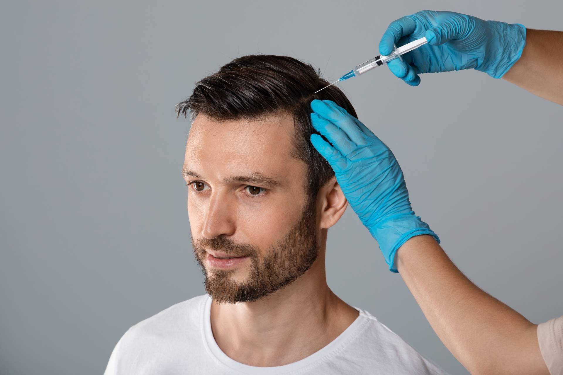Los tratamientos de mesoterapia, una alternativa muy recomendada para las personas que sufren alopecia según el doctor Jesus Mora