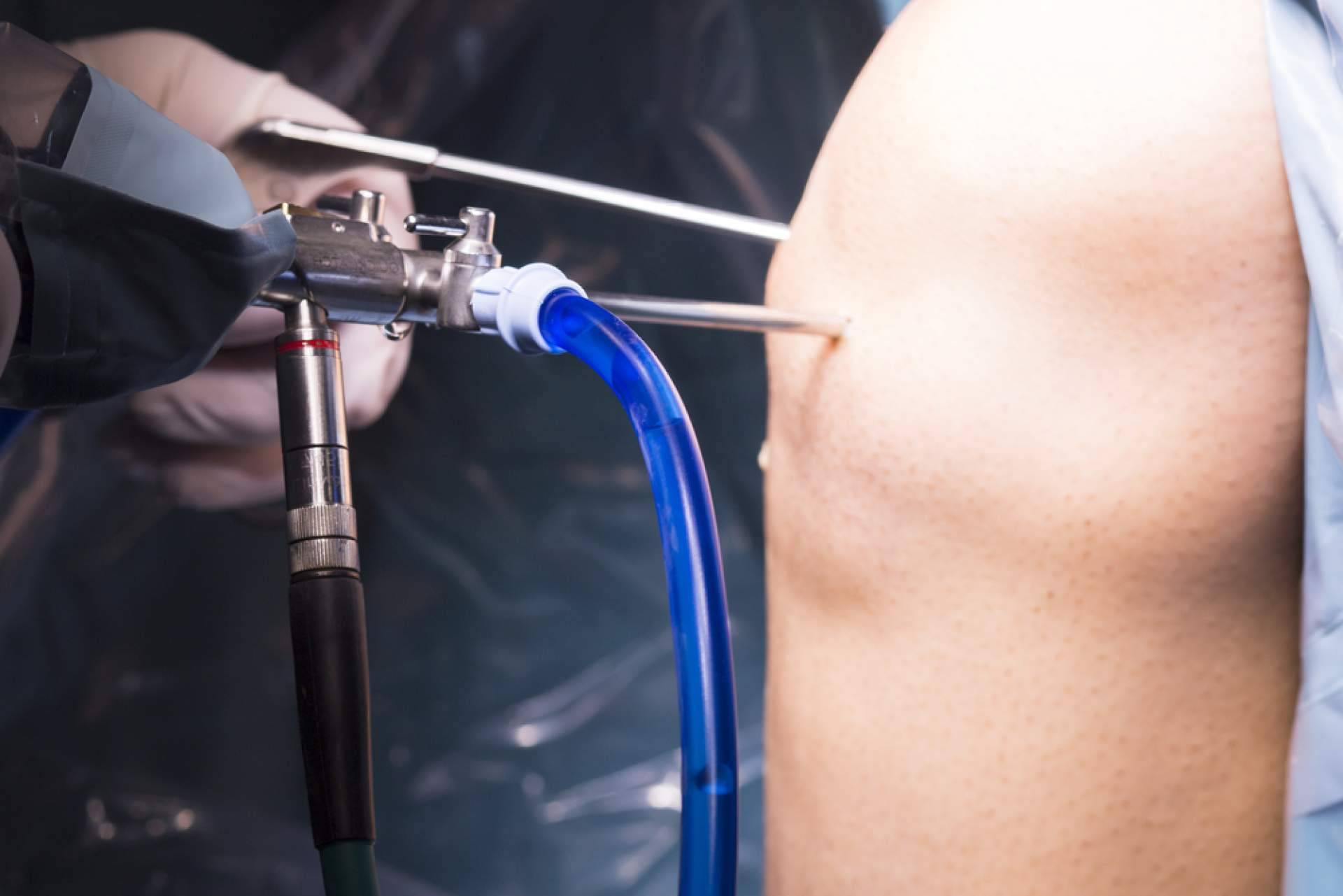 Tratamientos de artroscopia de rodilla en la Clínica Jaime I de Catarroja