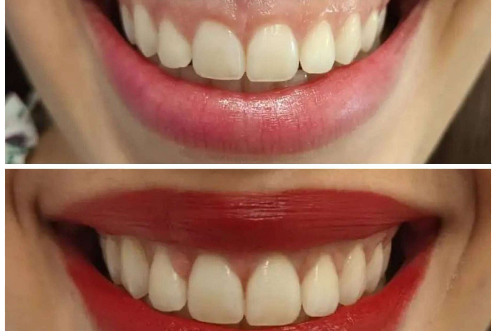Medicina estética facial y dental para una sonrisa perfecta de la mano de Clínica Calvo de Mora