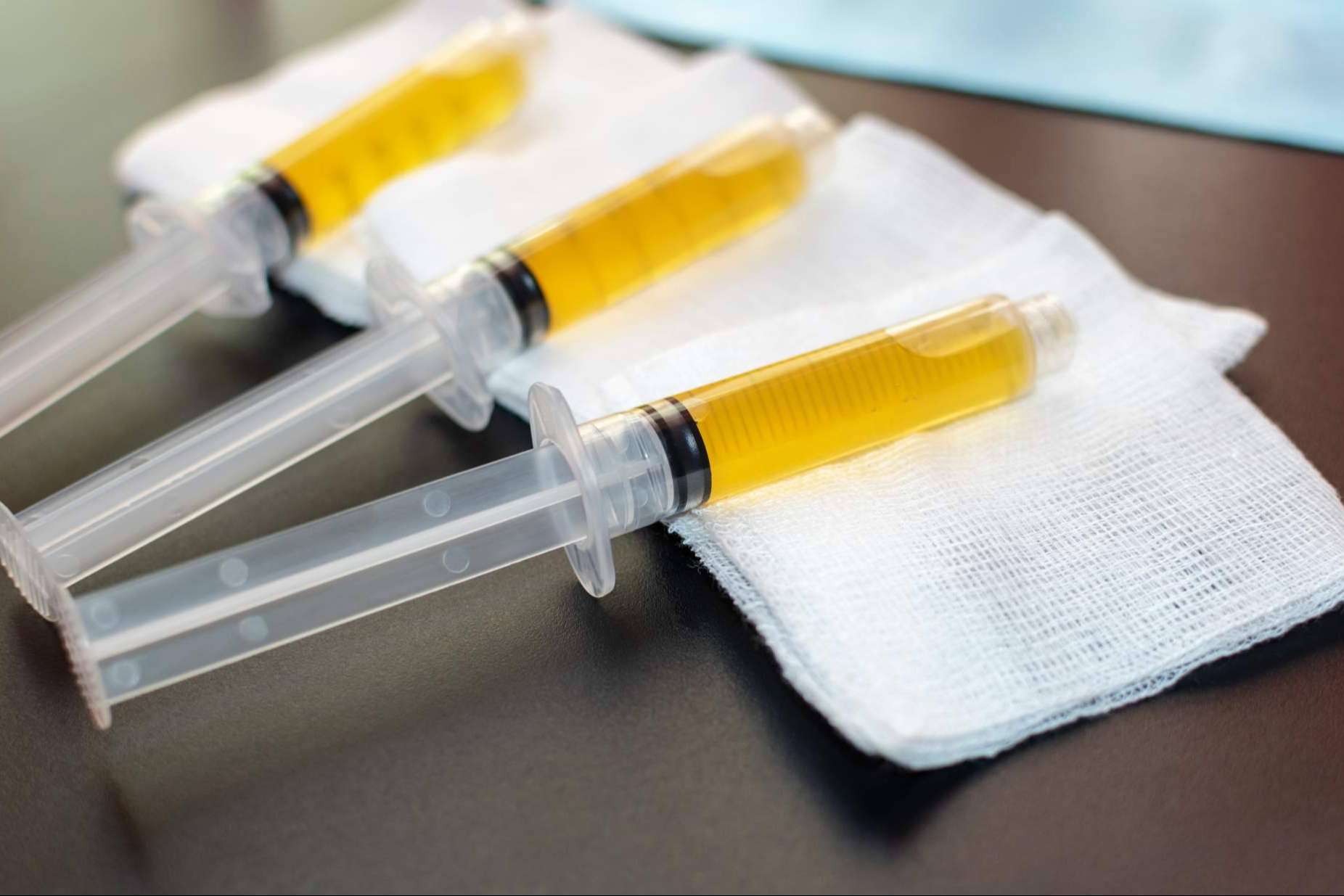 La relevancia del plasma rico en plaquetas en la traumatología
