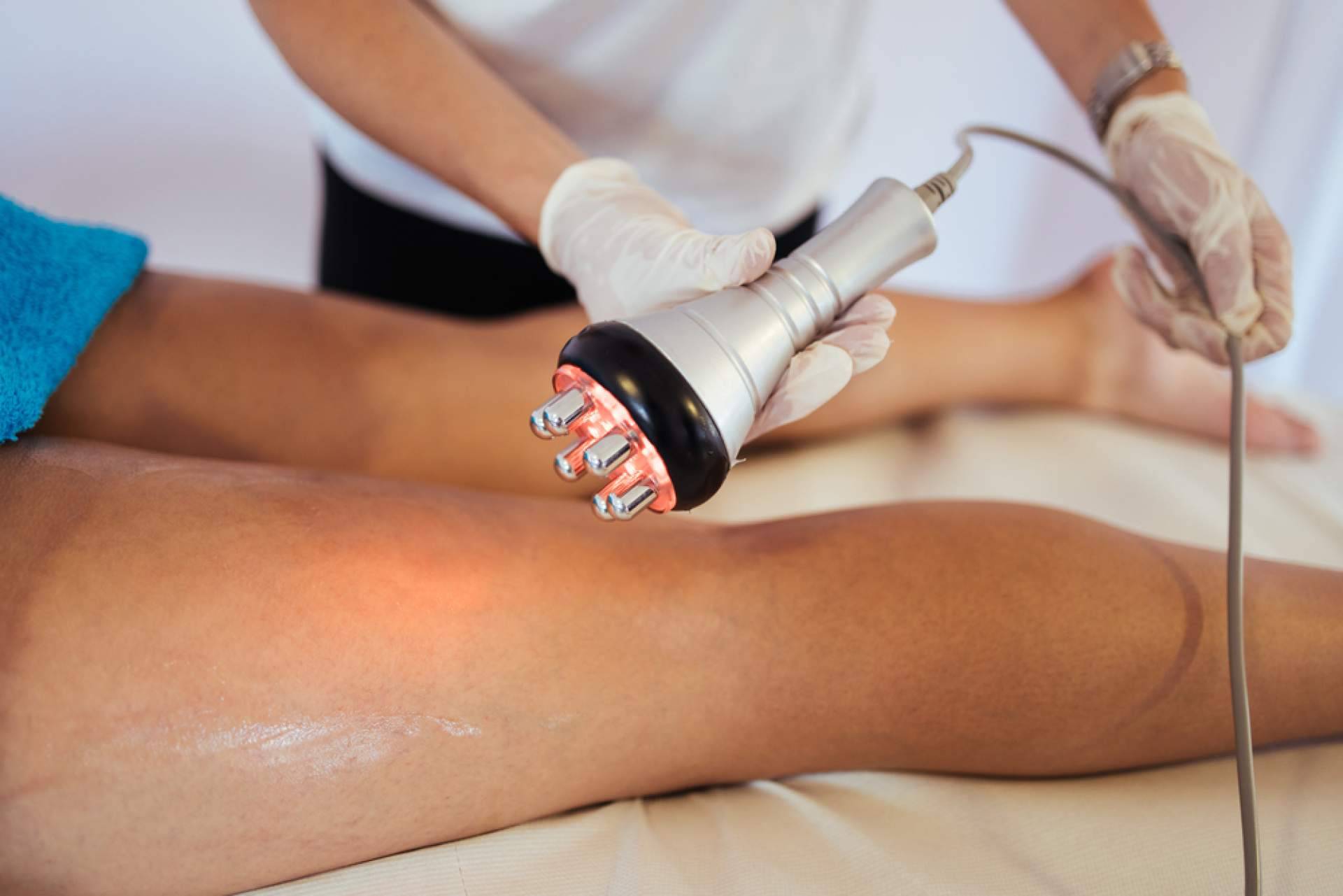 Eliminar estrías con los tratamientos de Centro Estética El Pilar
