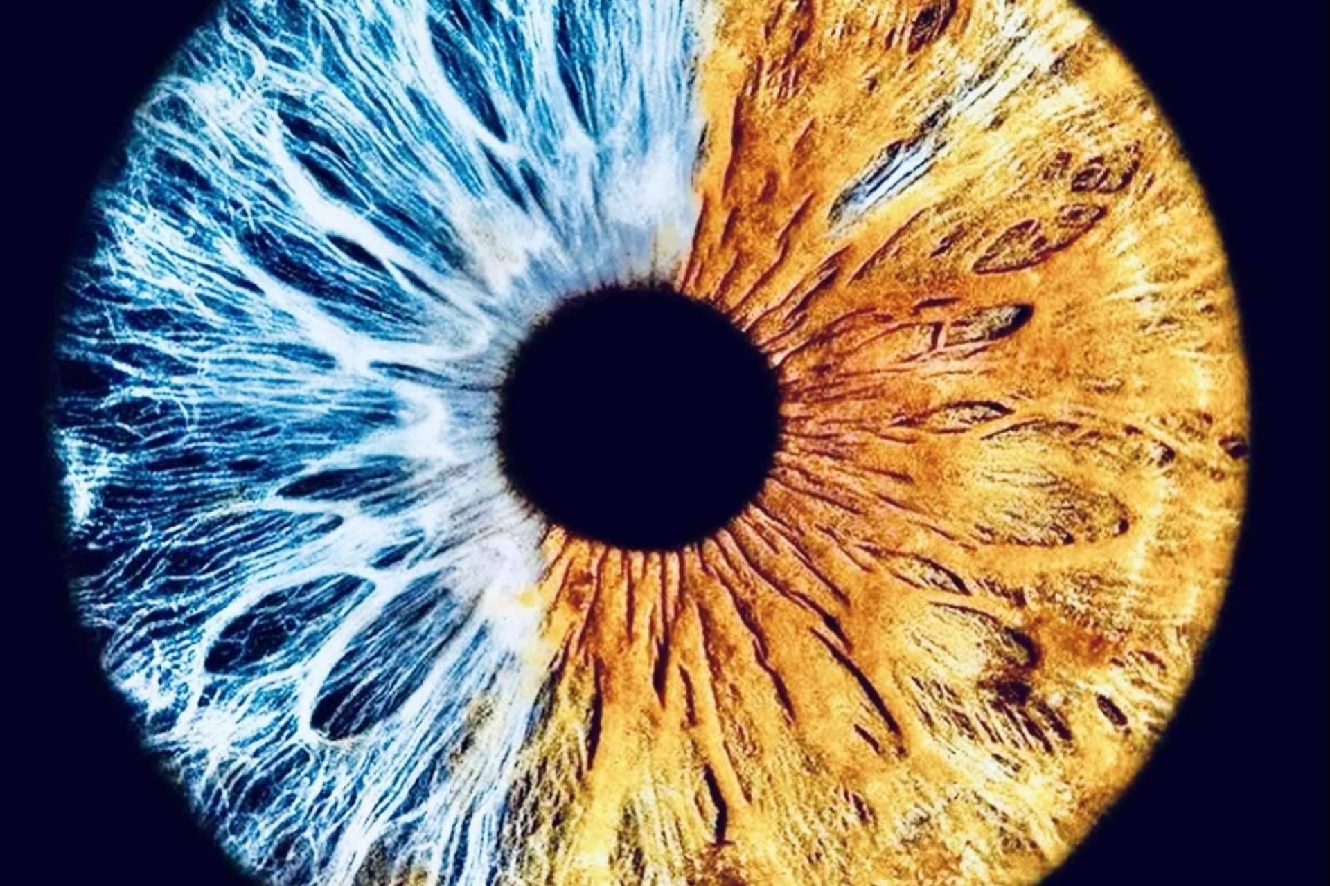 La pigmentación de los ojos se puede clasificar en 5 grados, según los especialistas de Eyecos
