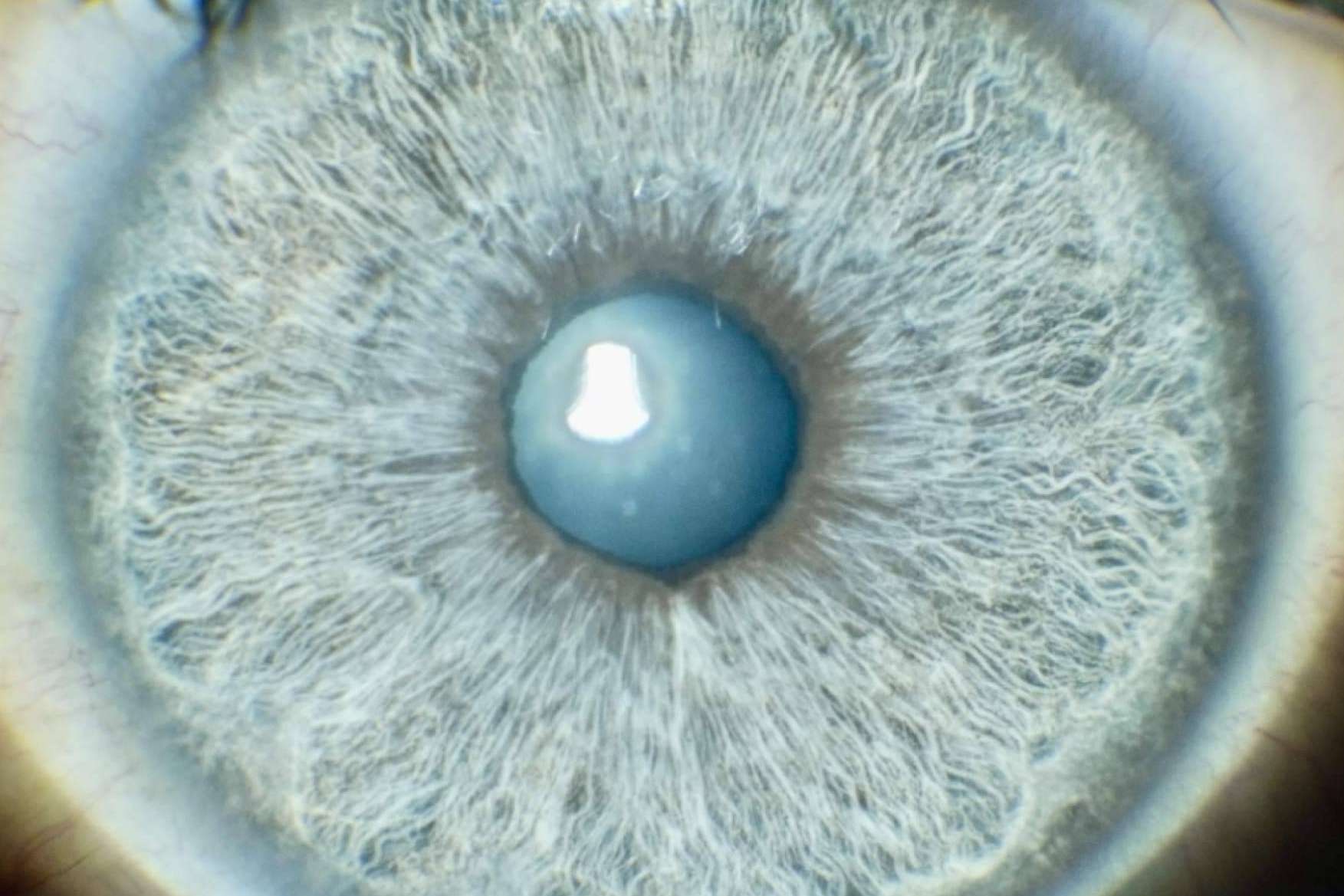 Eyecos explica qué implica cambiarse el color de los ojos con láser, por Eyecos