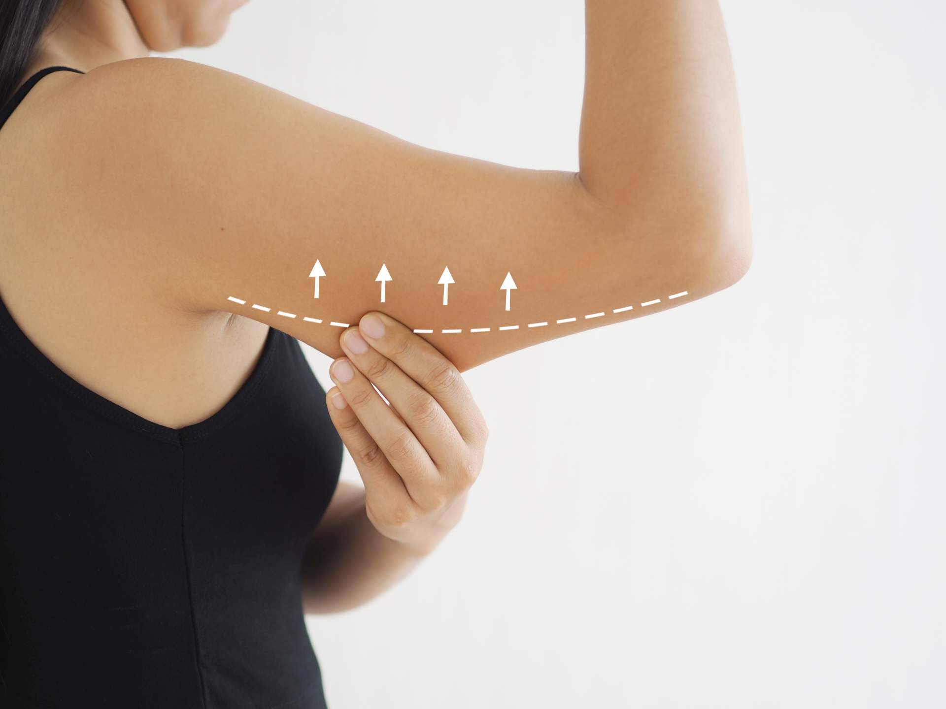 ¿En qué consisten los tratamientos anticelulíticos saludables de Cuerpo Libre?