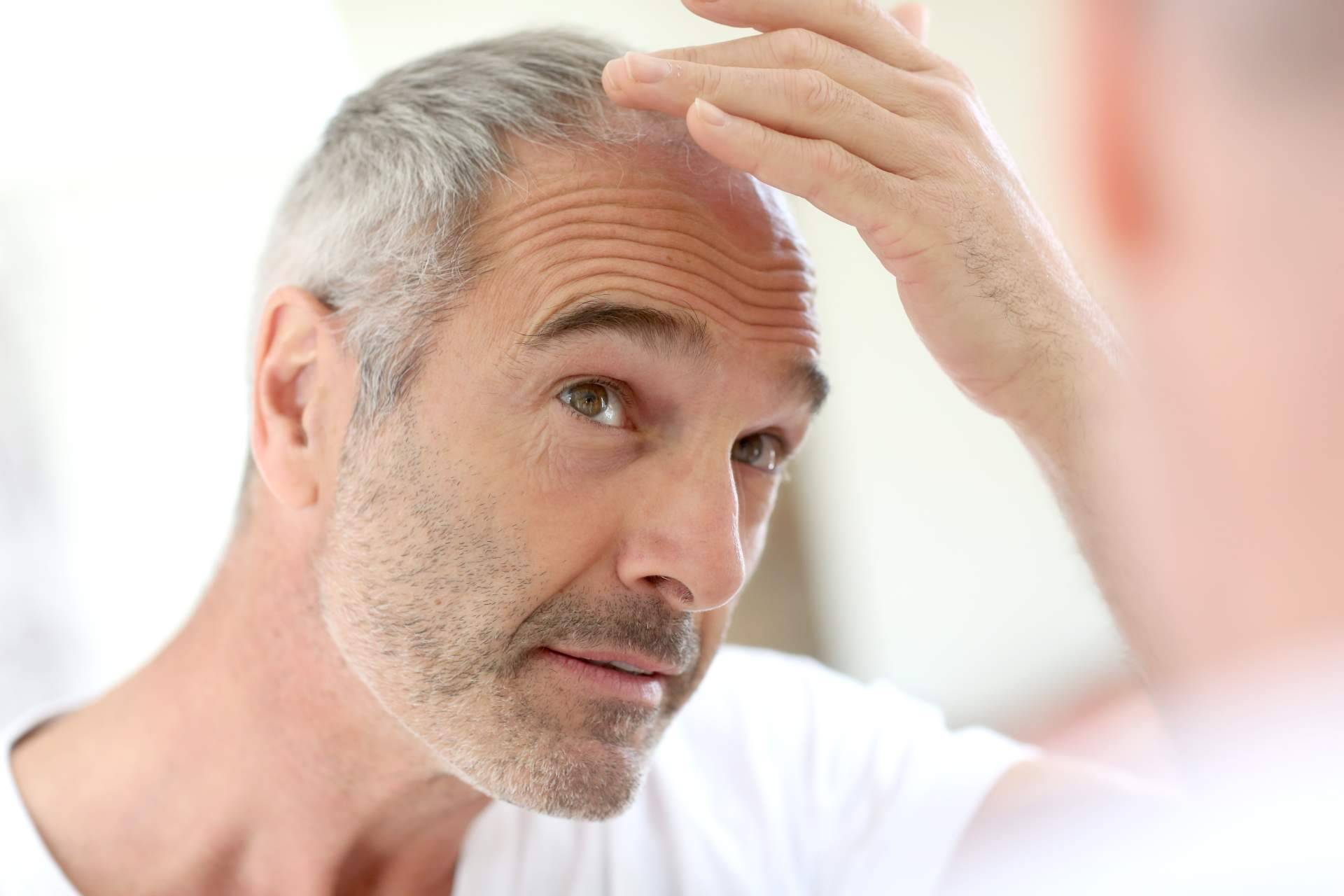 FarmaSky y su línea de productos de Vichy Dercos, refuerzan, fortalecen y reequilibran el cabello desde la raíz